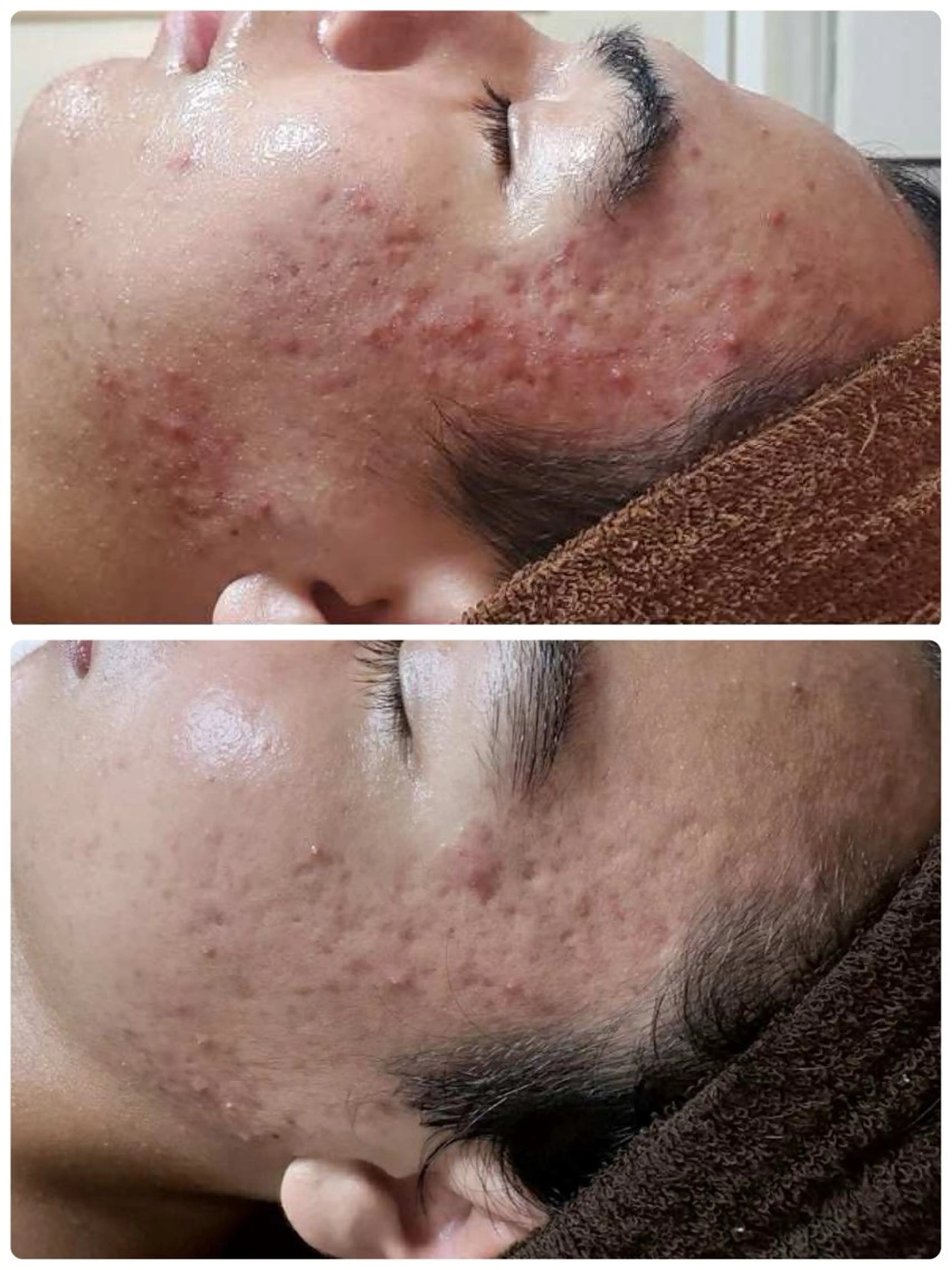 エステ トバル ユリコのエステ・リラクイメージ