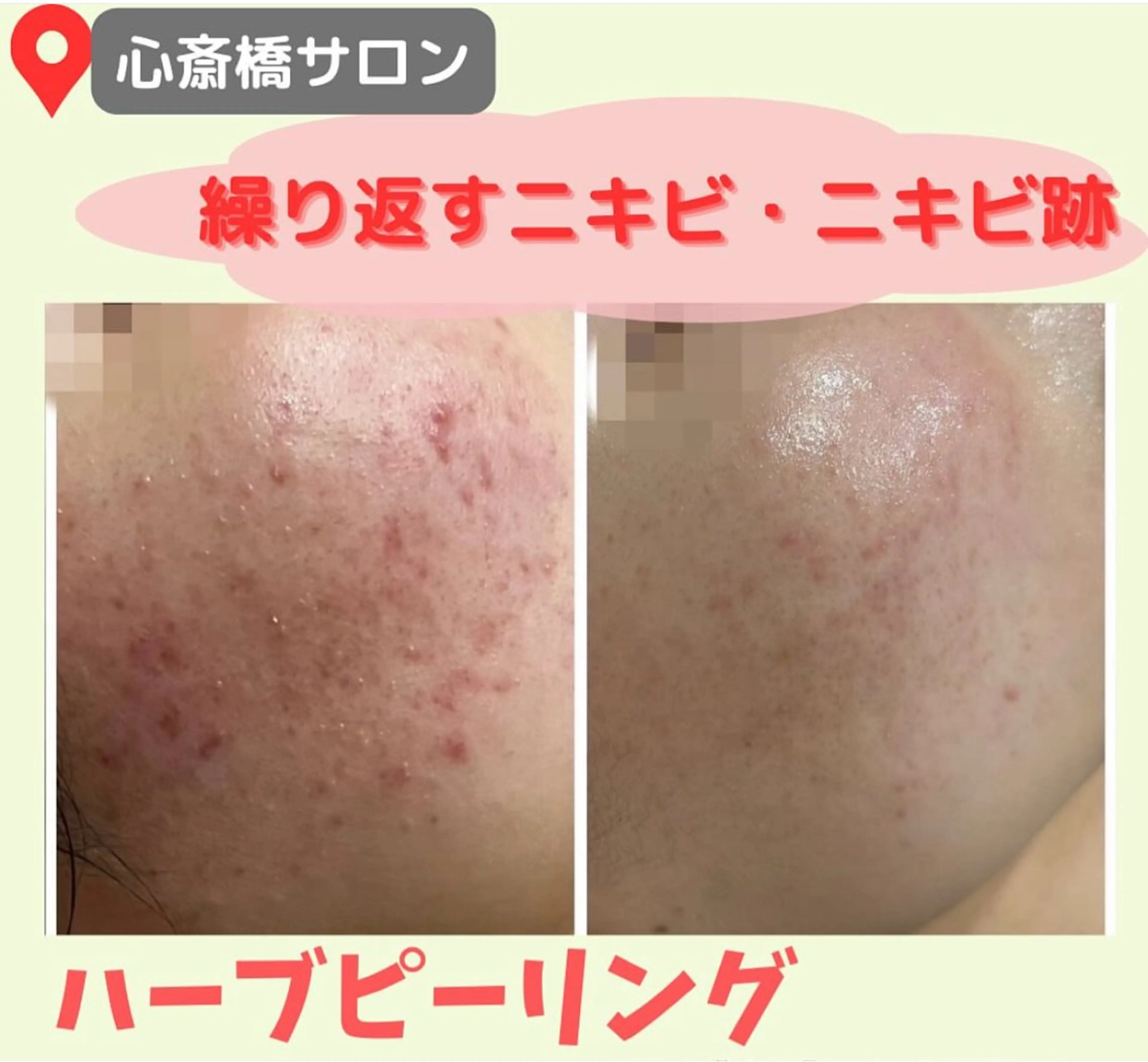 美肌脱毛サロン muroのエステ・リラクイメージ