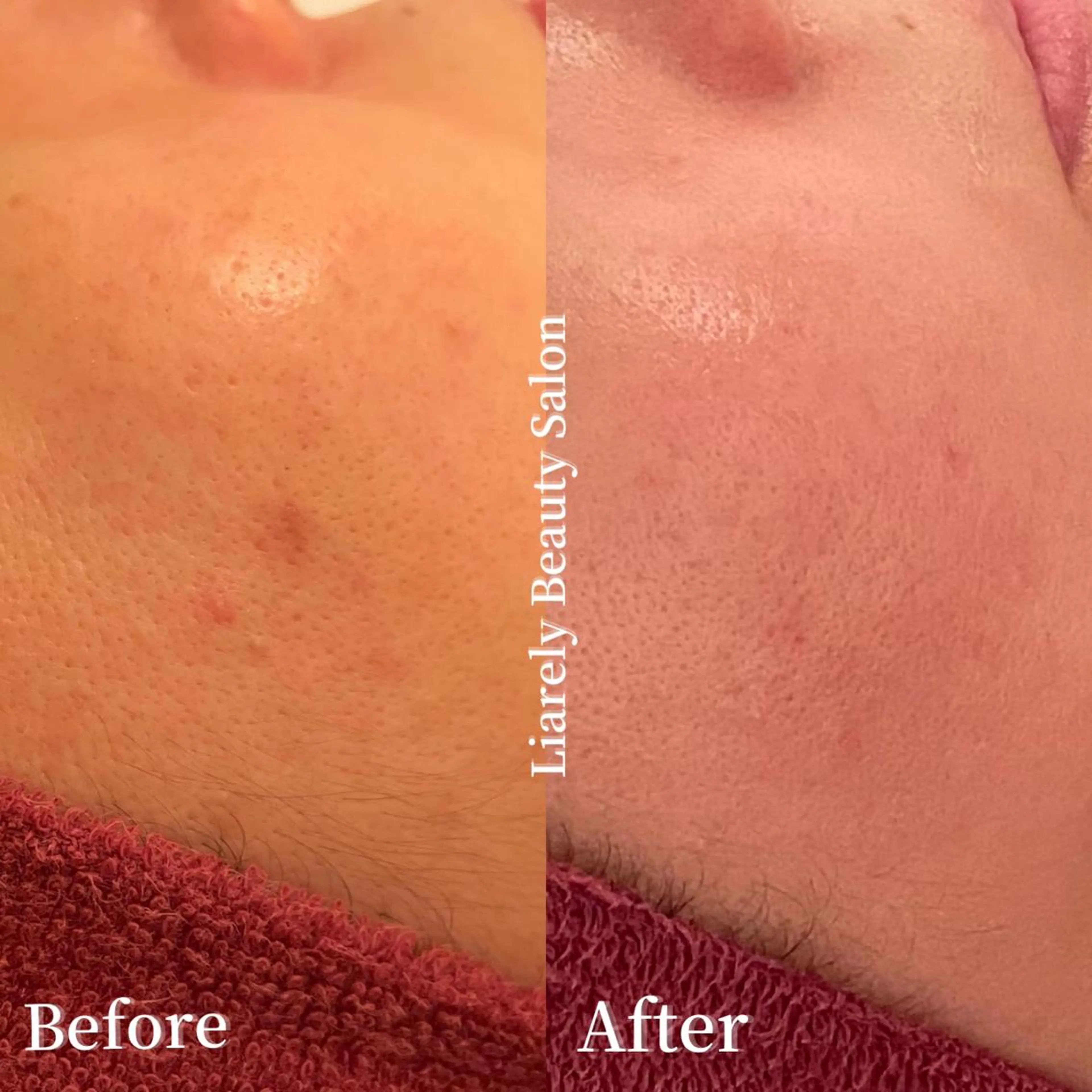 エステ リアレリー 🪞🌹Ryokoのエステ・リラクイメージ