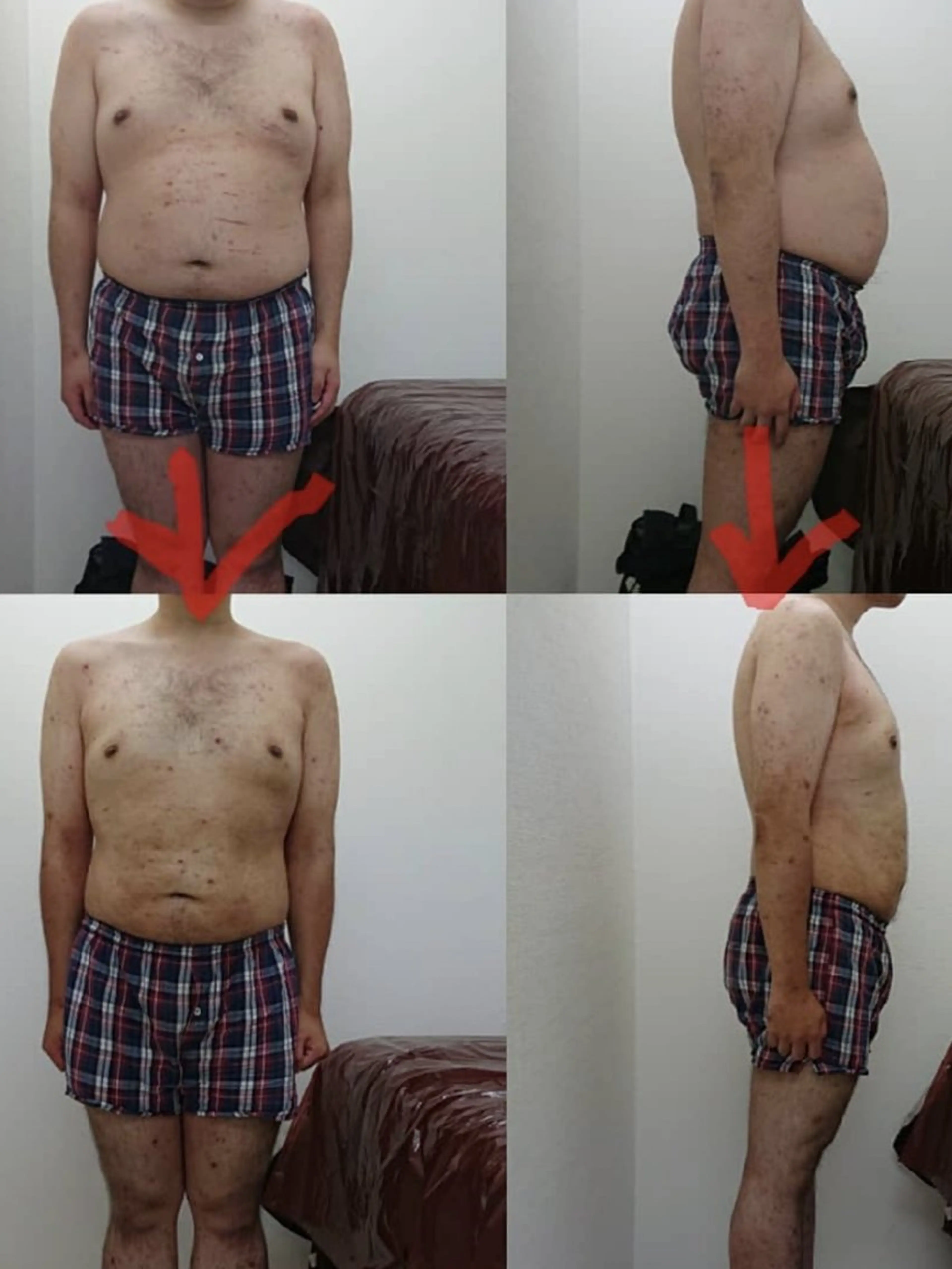 120分×（3回来店）マシン痩身がっつりサイズダウン短期集中コースの写真