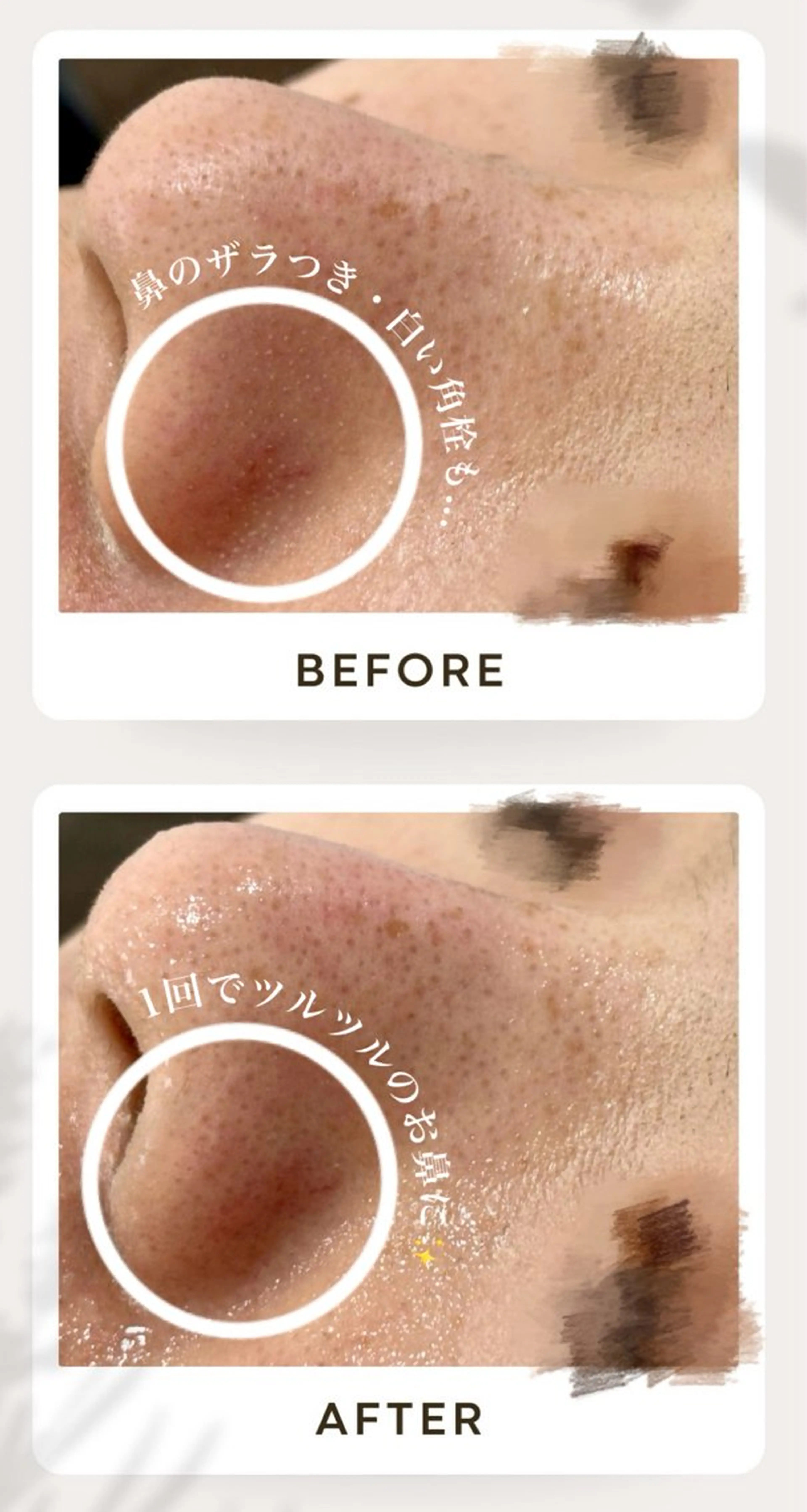 AY'S所属・倉敷/玉島/20代 からの大人毛穴洗浄のエステ・リラクイメージ