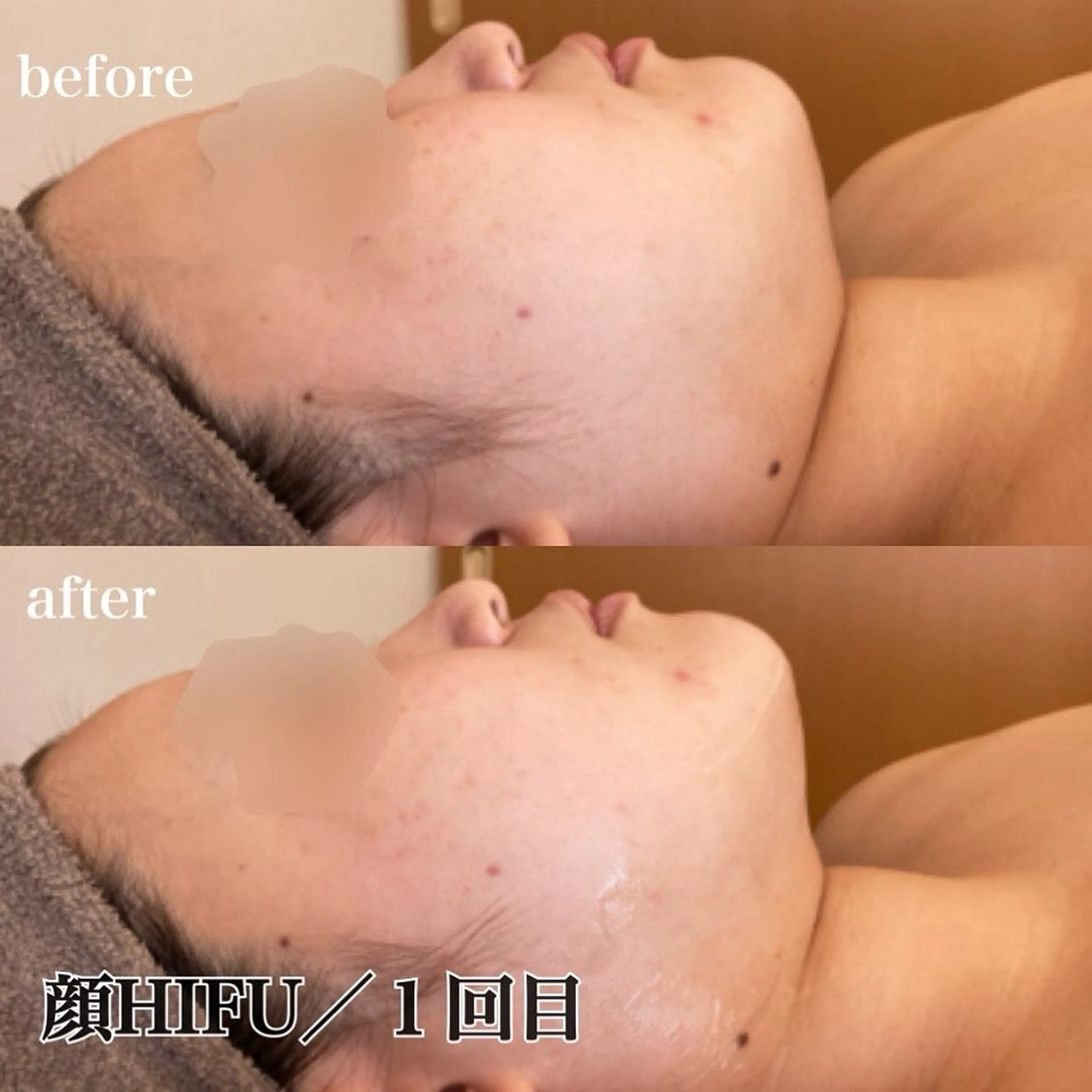 磐田｜LAYLA 一番丁寧な脱毛店のエステ・リラクイメージ