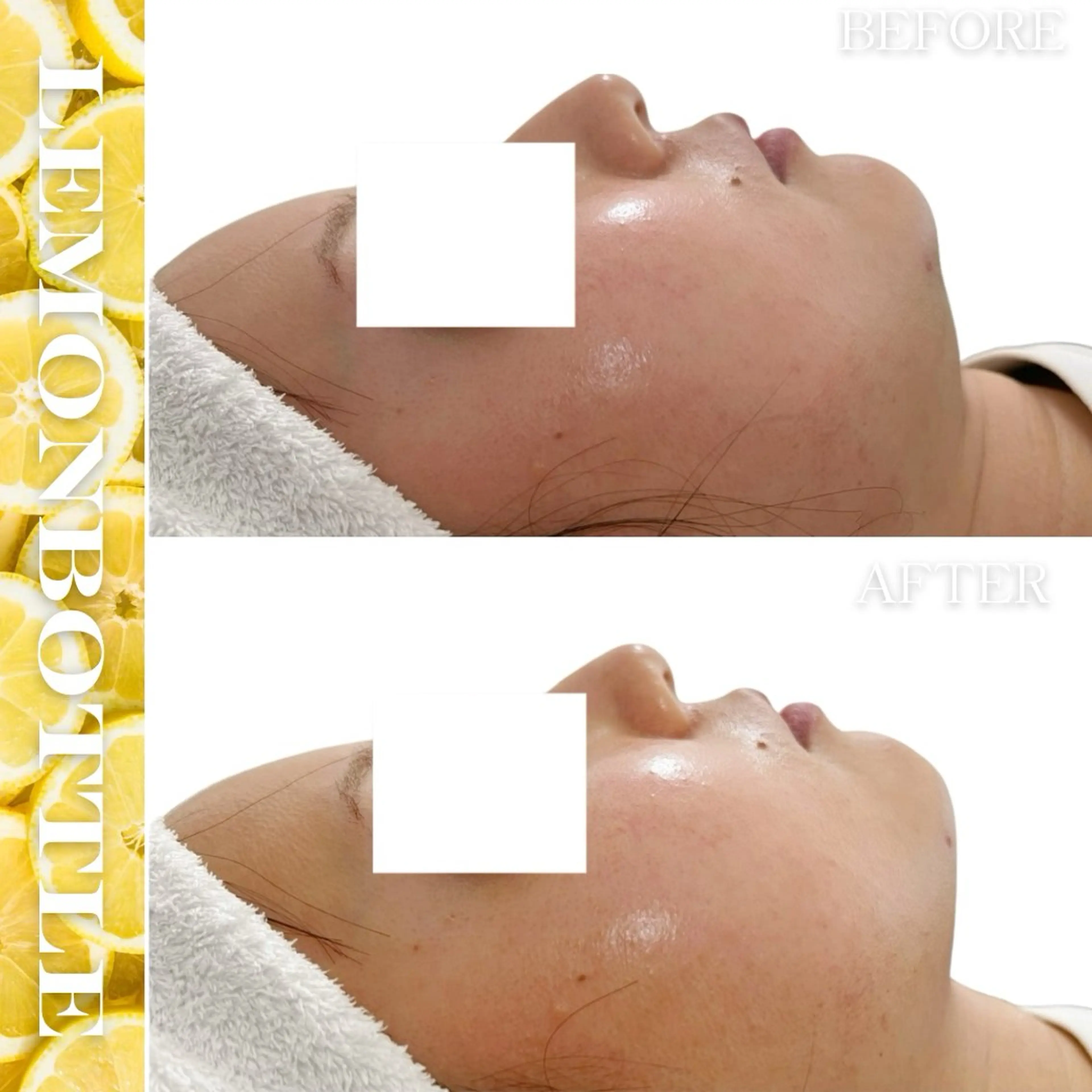 Liam《美肌管理/ 3D小顔/脂肪ケア》のエステ・リラクイメージ