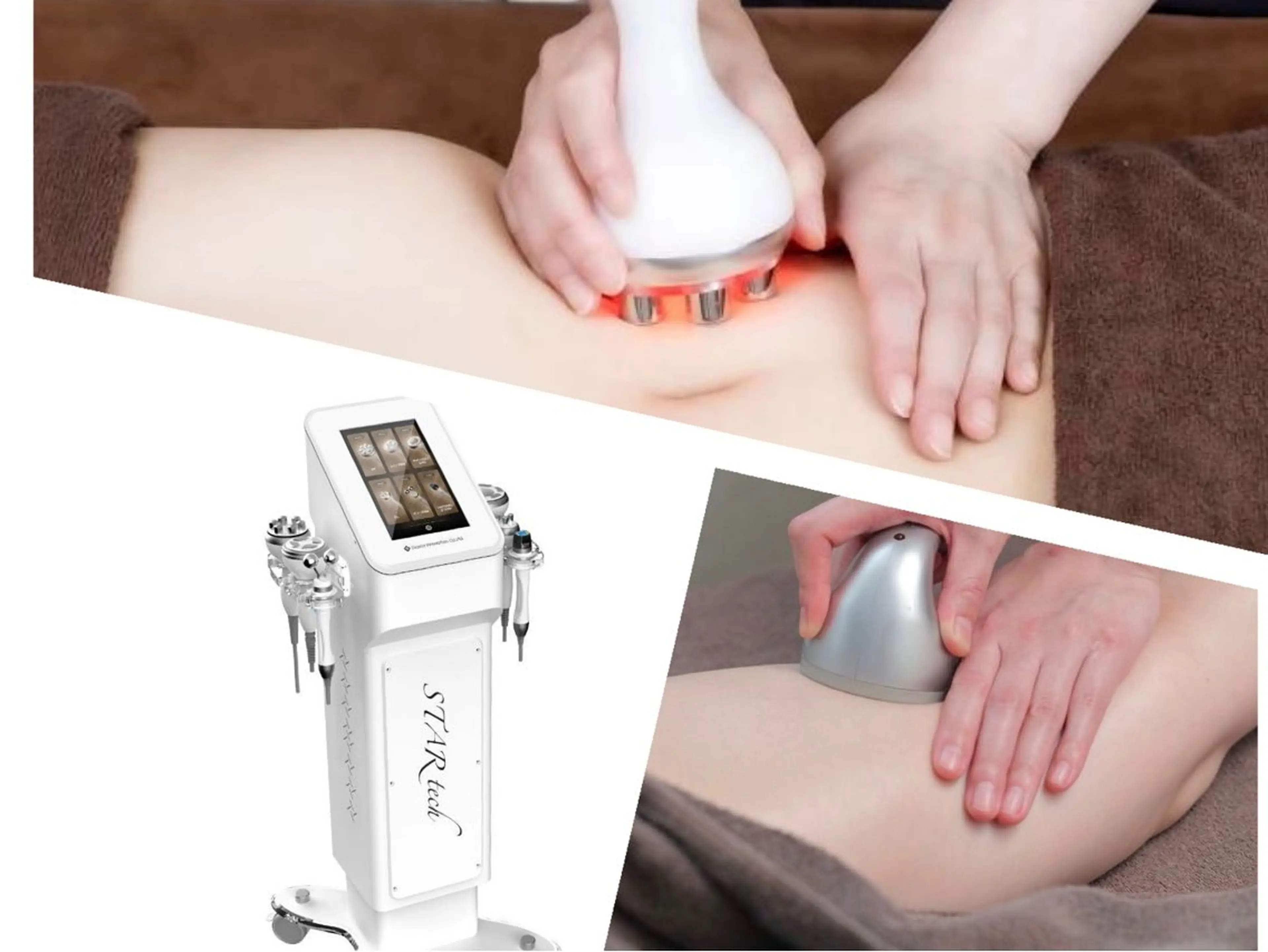 エスティNo1人気のセル！徹底的撃退コース☆体験コース☆¥4000の写真