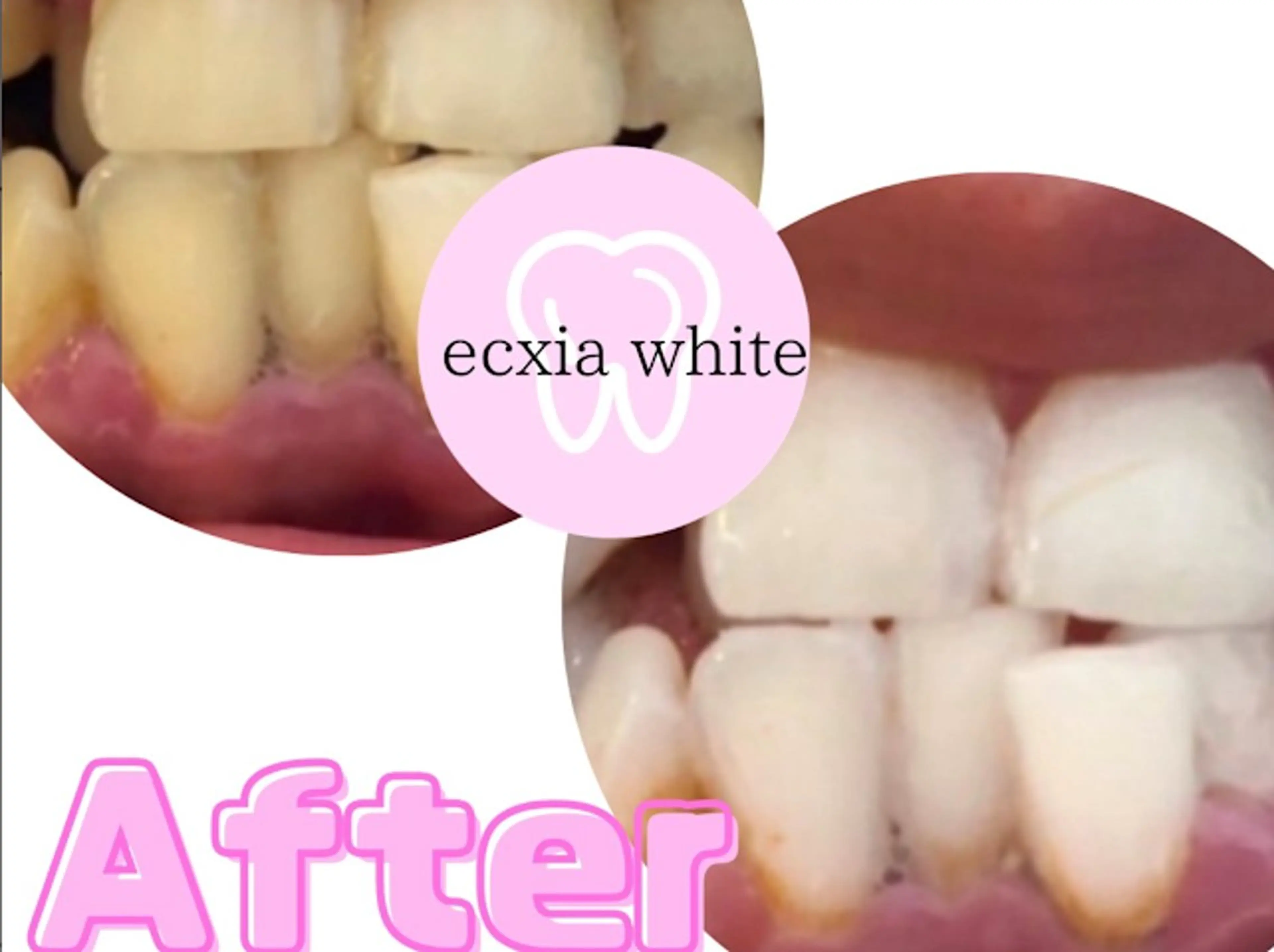 エステ セルフホワイトニング エクシア浜松店のエステ・リラクイメージ