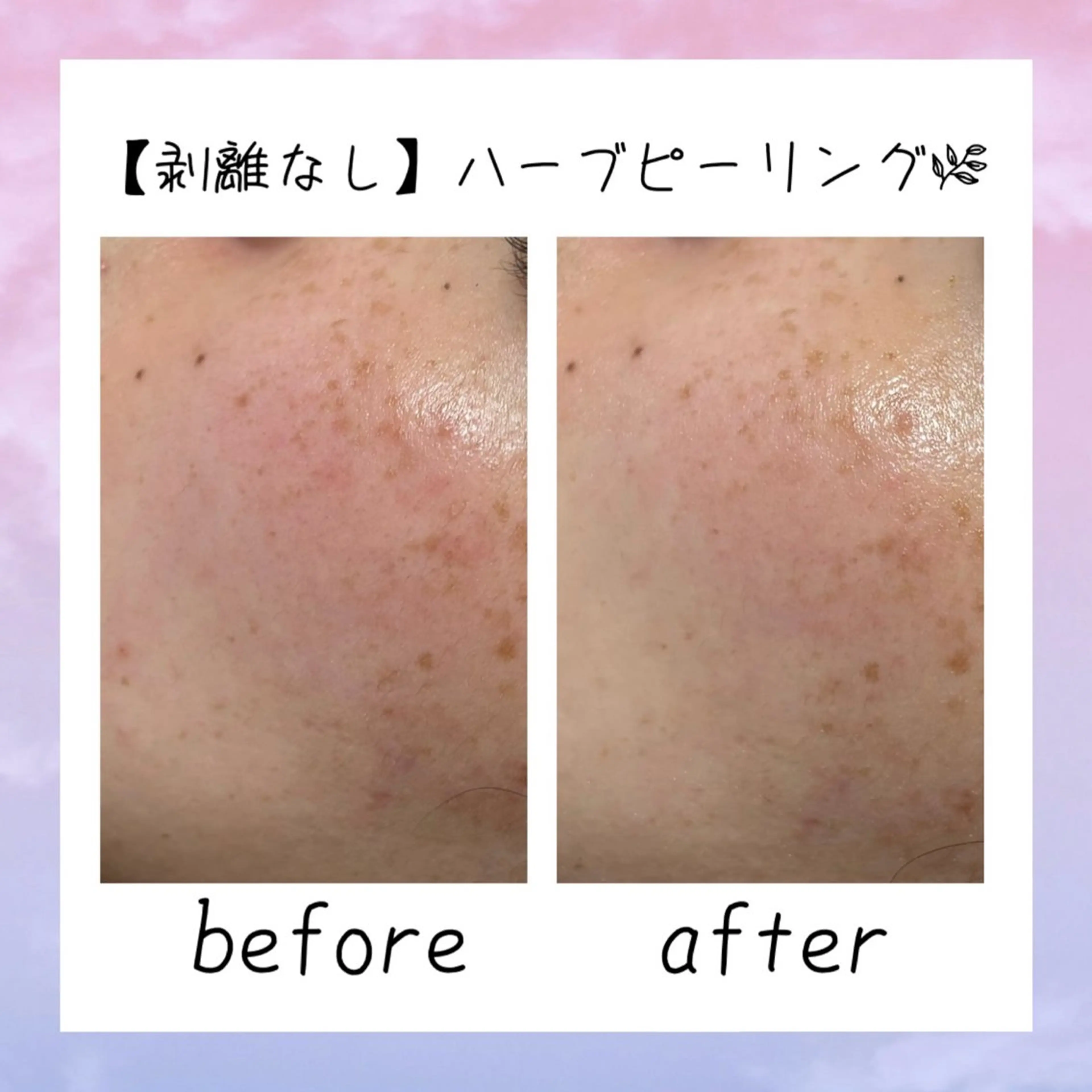 肌質改善Charme coco  増毛のエステ・リラクイメージ