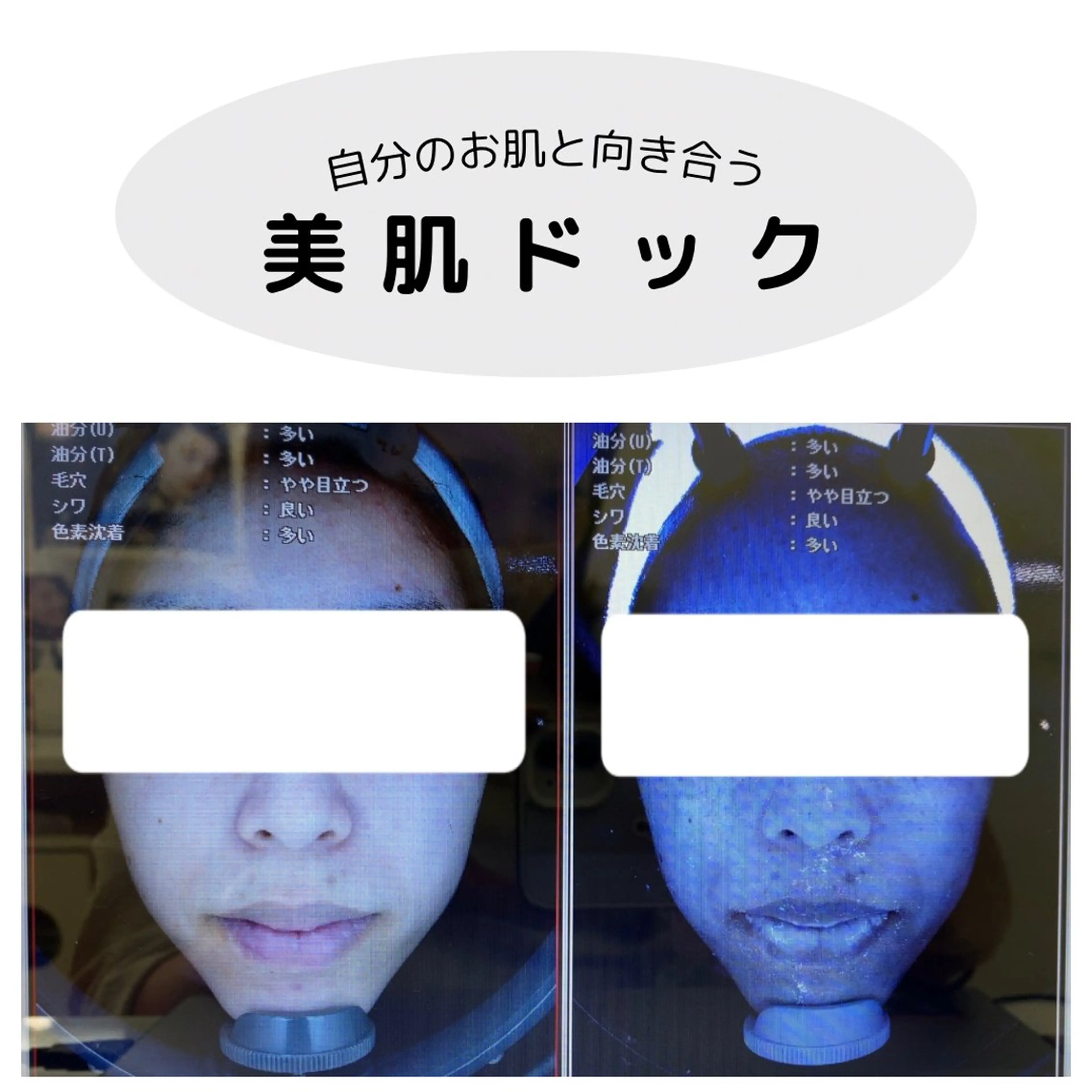 デ・アイム新潟北所属・サイトウ .のエステ・リラクイメージ