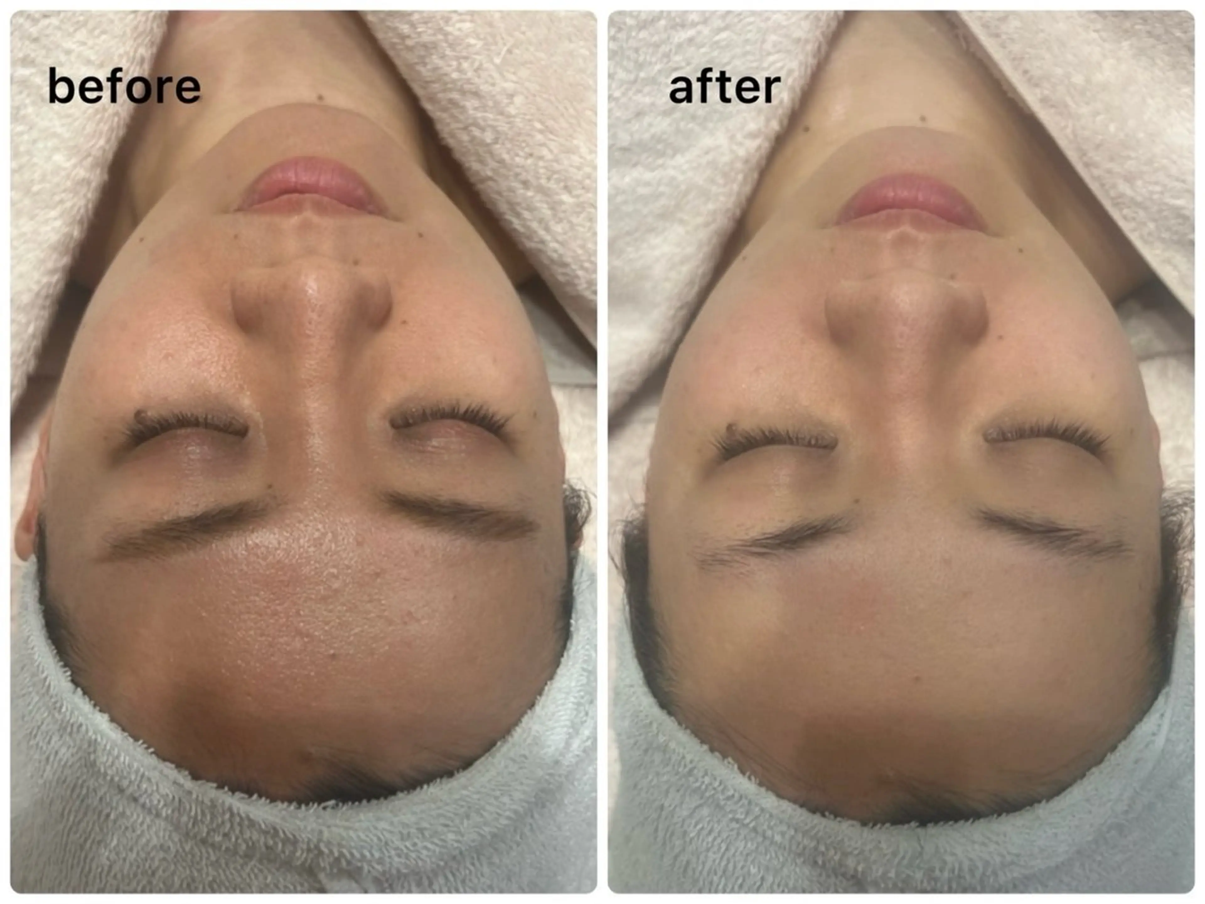 エステ メナードフェイシャルサロン　リンガーデン所属・山口 郁代のエステ・リラクイメージ