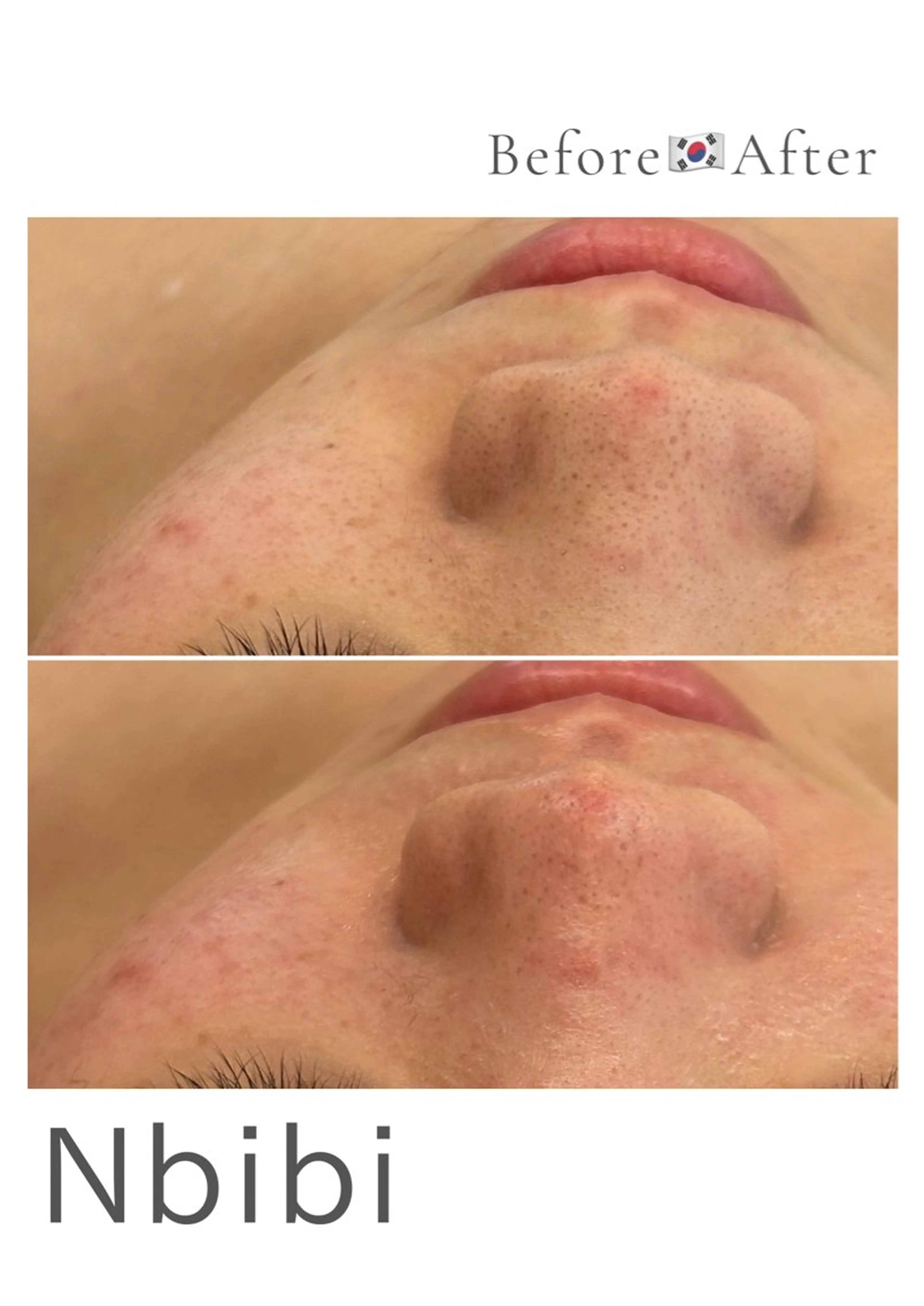 韓国🇰🇷価格 サロン_Nbibiのエステ・リラクイメージ