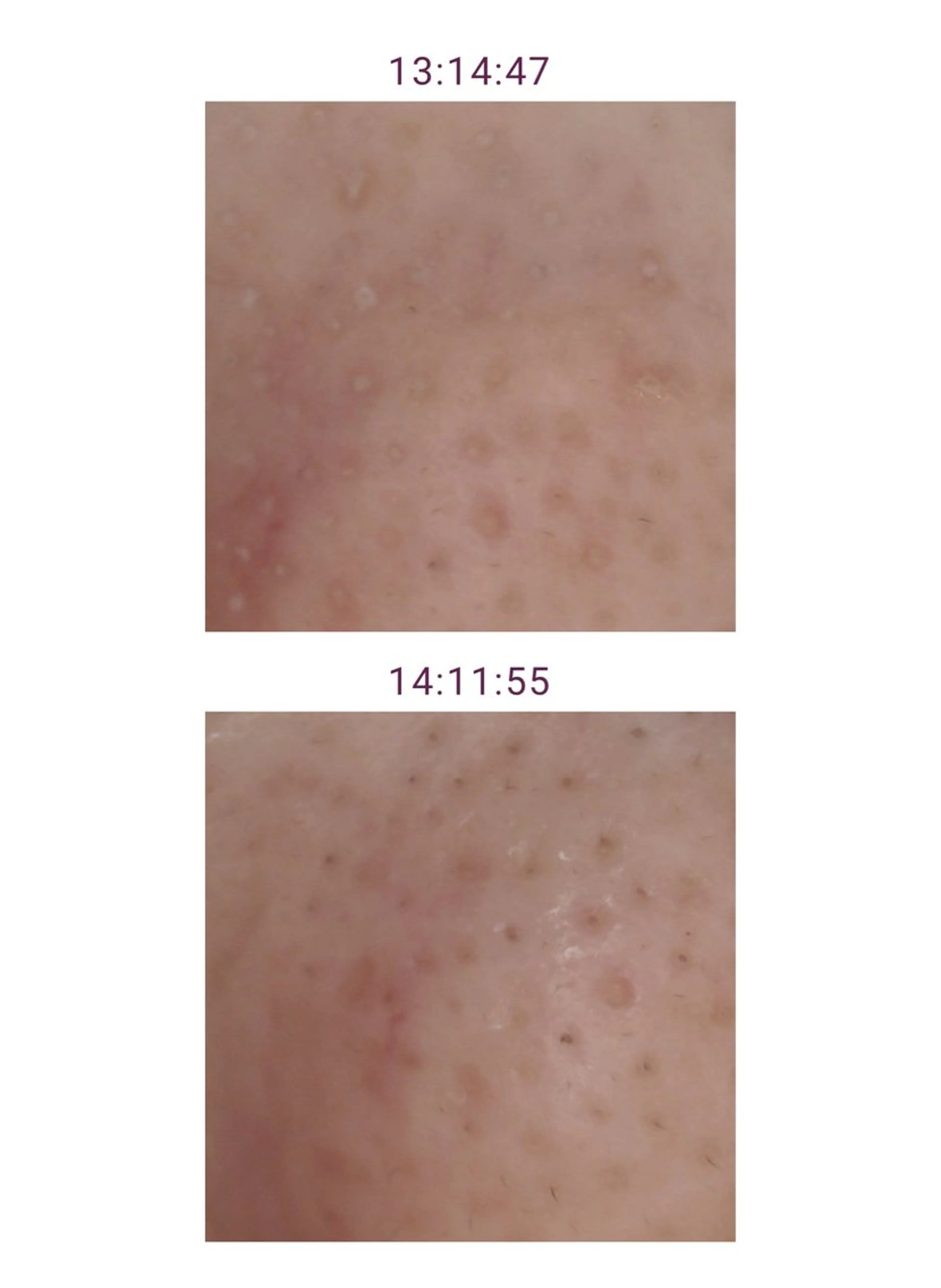 メナードフェイシャルサロン　リンガーデン所属・山口 郁代のエステ・リラクイメージ