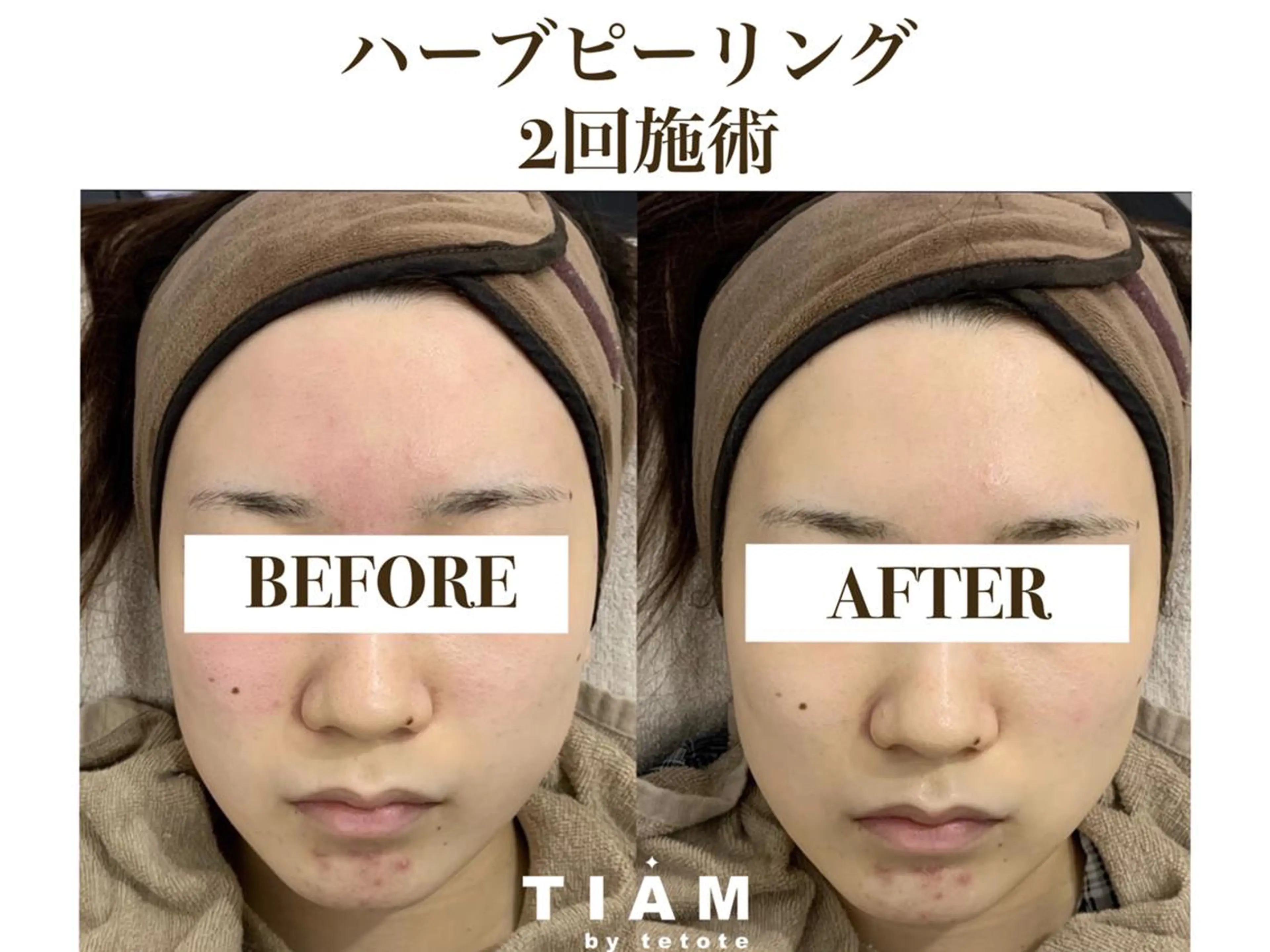 美肌サロンTIAM by tetoteのエステ・リラクイメージ