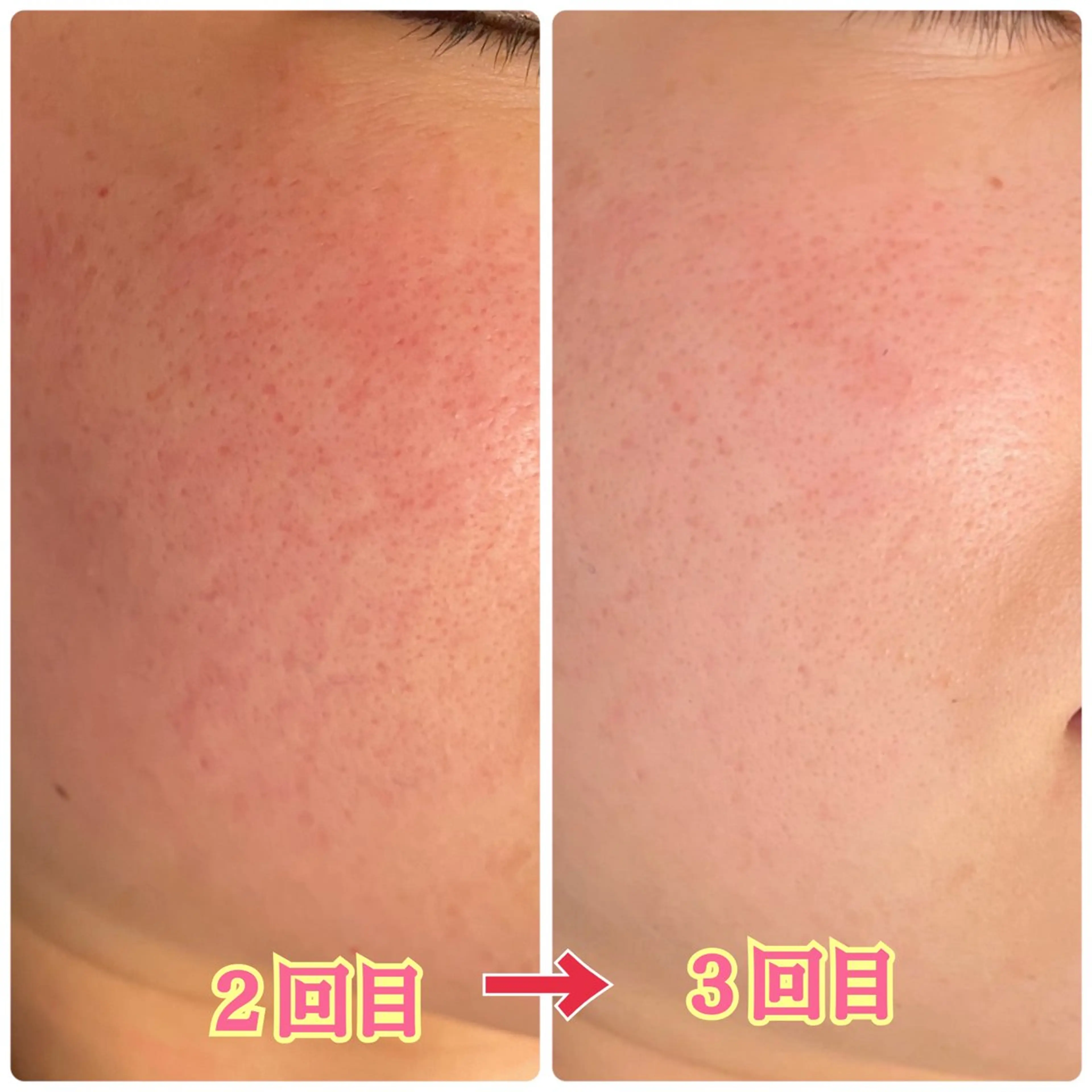 鹿の子台　プライベートサロン　芹花〜SERIKA〜所属・稲角 芹香のエステ・リラクイメージ