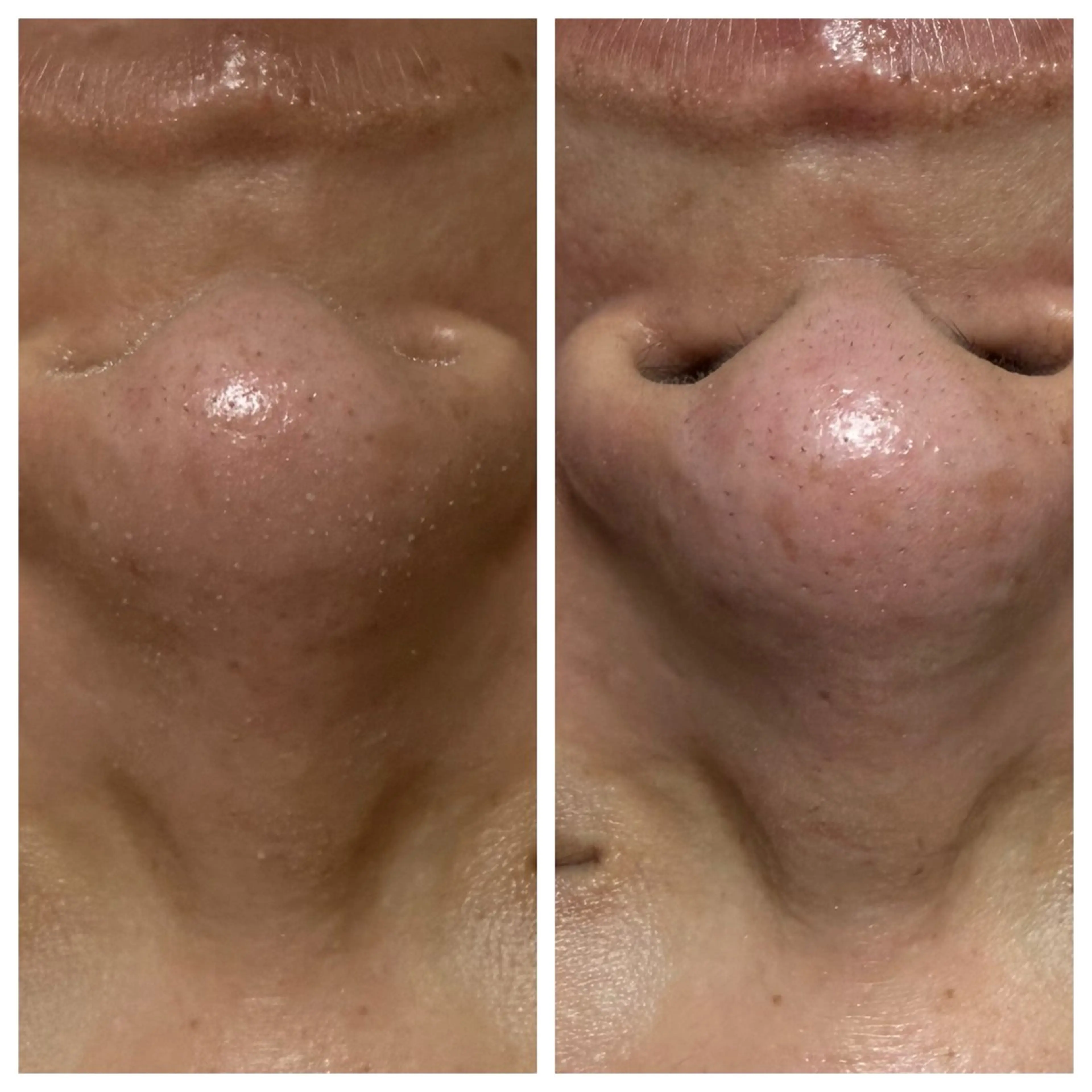 メンズ エステ LUCIALL  ルシアル所属・児玉 愛由美のエステ・リラクイメージ