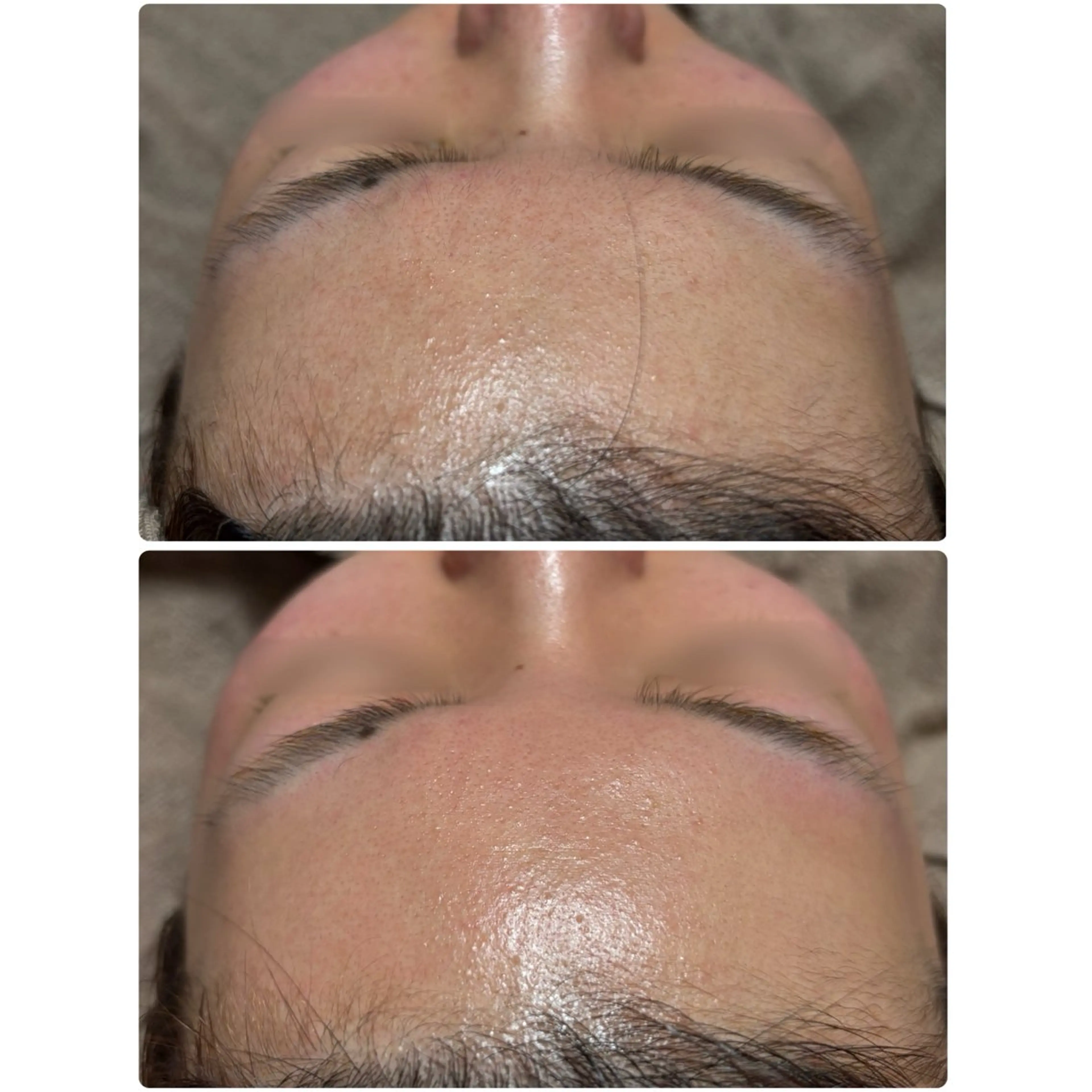 脱毛 any ［Hata Aya］のエステ・リラクイメージ