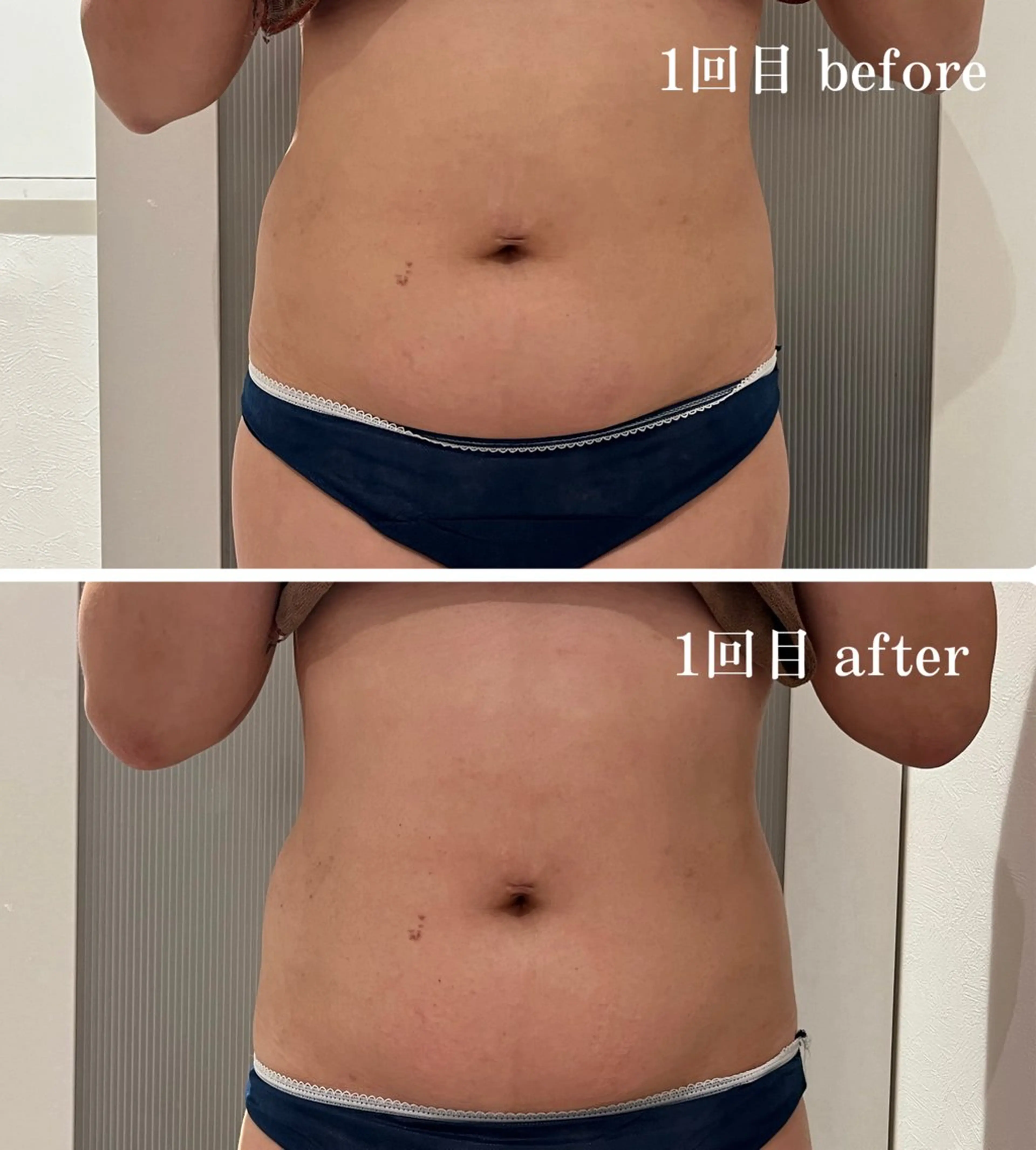 Folche所属・Folcheはません 森山のエステ・リラクイメージ