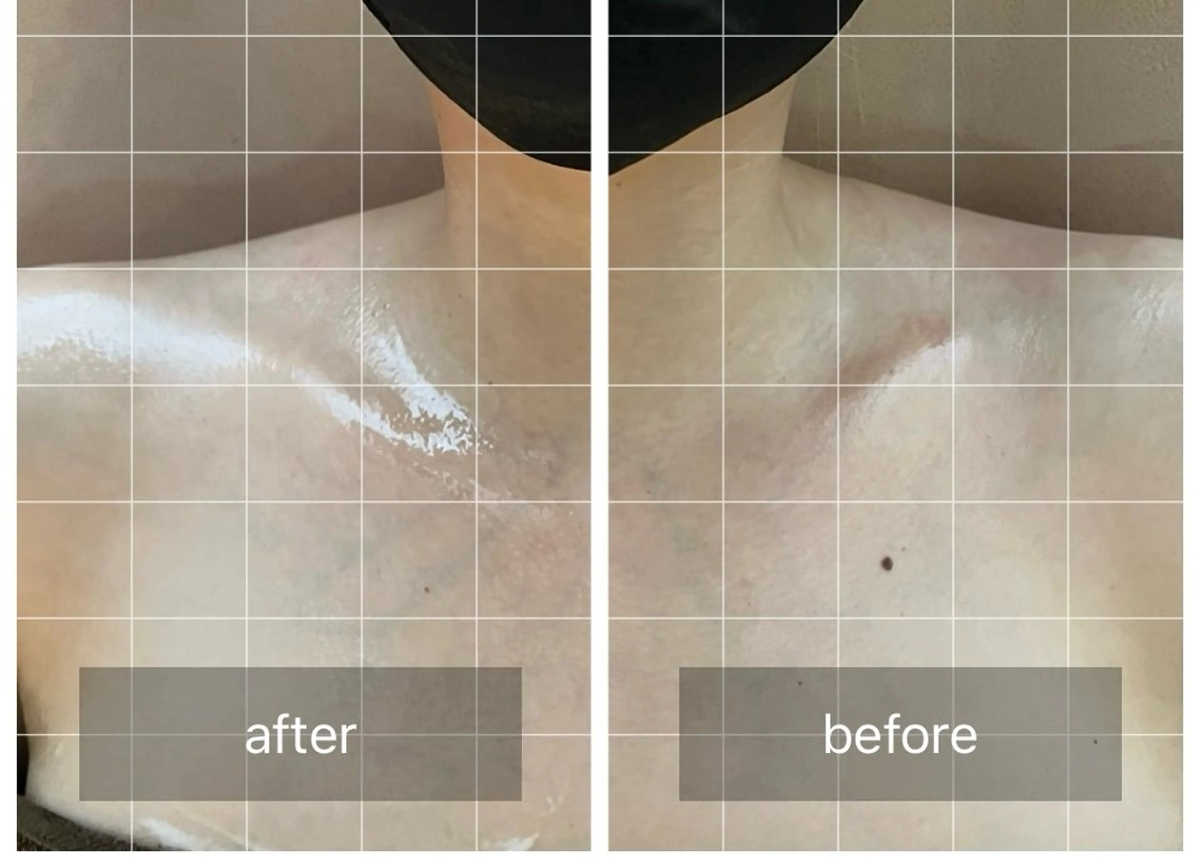 心斎橋痩身ダイエット 韓国.美容鍼.小顔のエステ・リラクイメージ