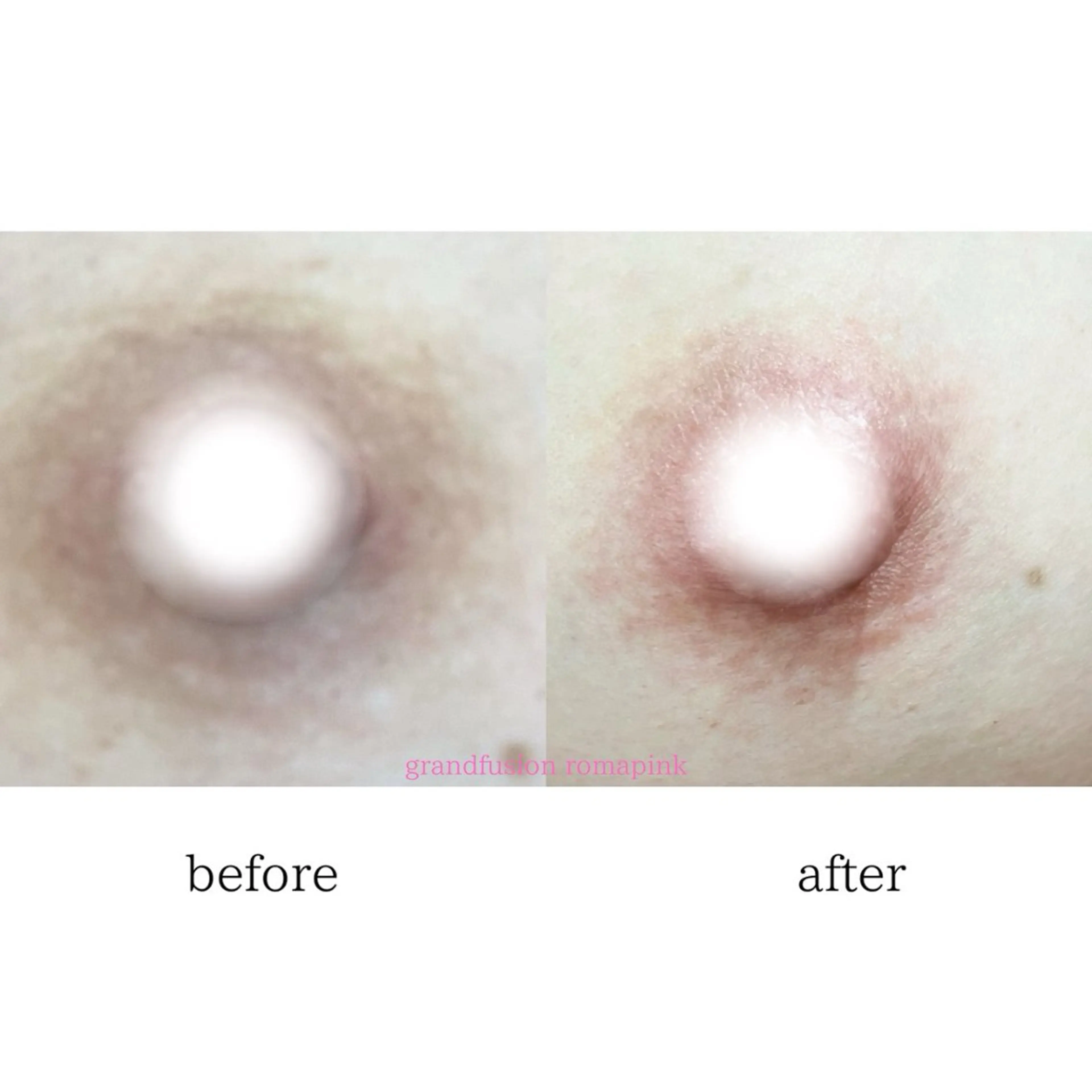 小顔専門看護師クリニカルサロンCOCO所属・小顔と美肌サロン クリニカルサロンココのエステ・リラクイメージ