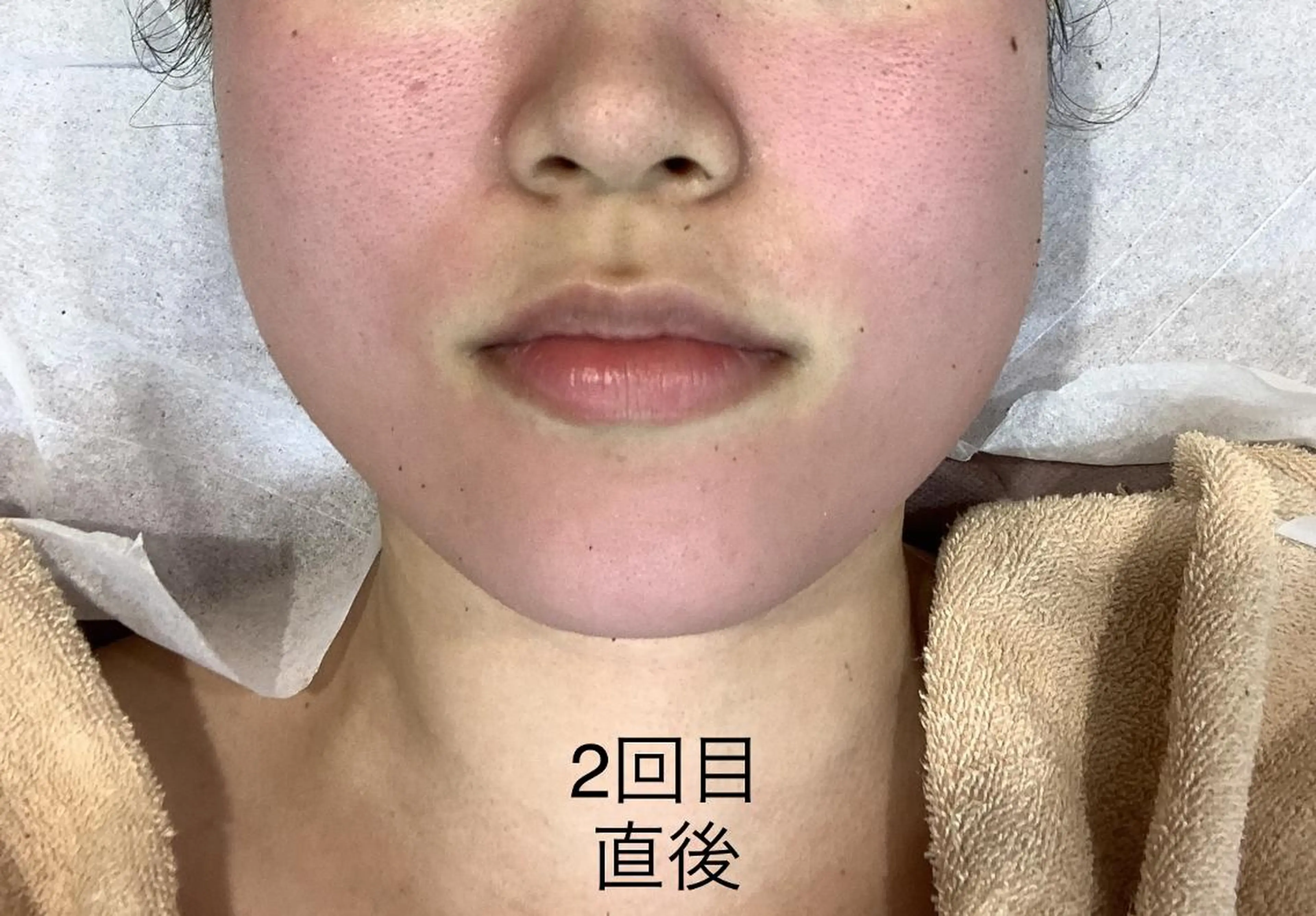 エステ リラク U24限定クーポン レイビス池袋MANAのエステ・リラクイメージ