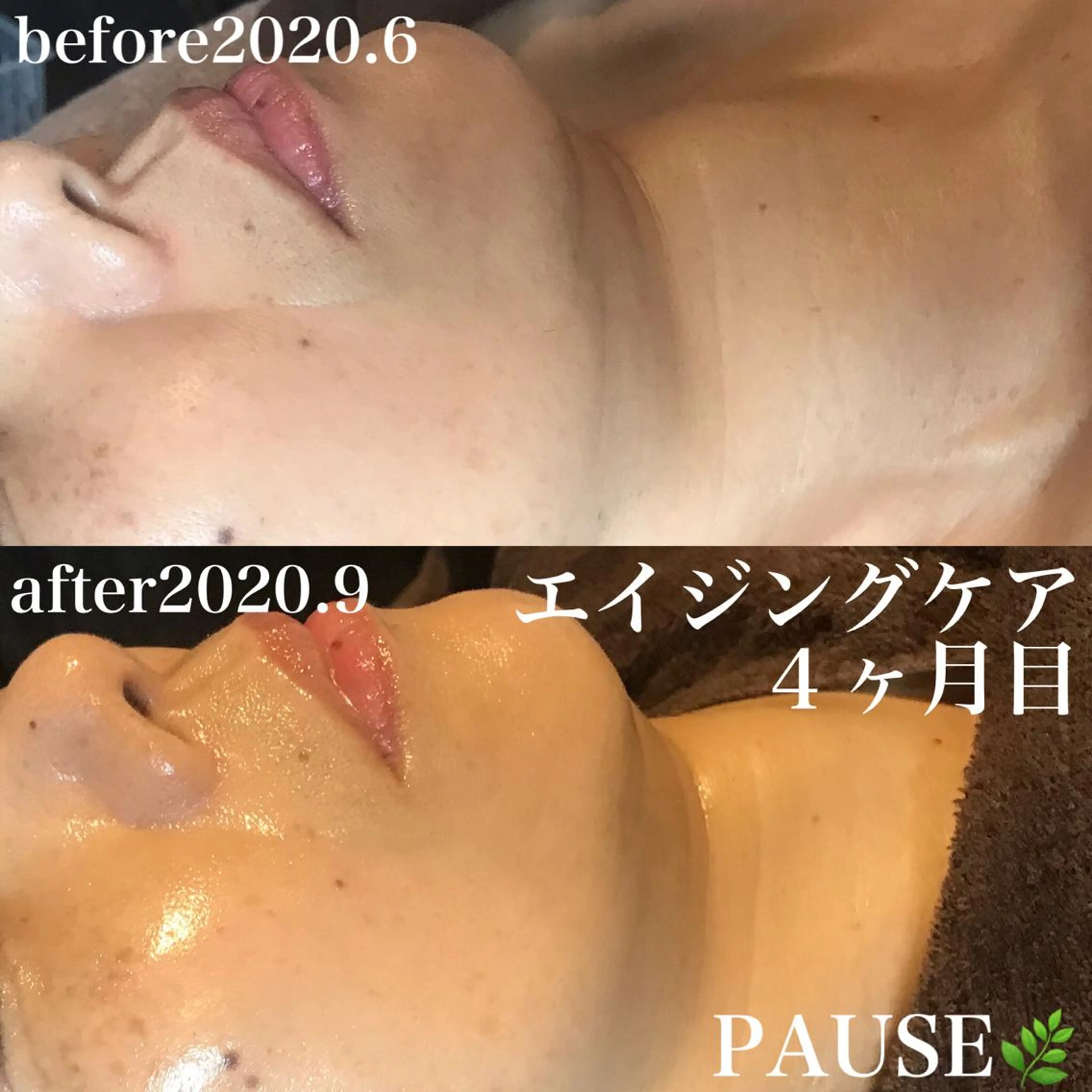 エステ 浜野 恵美のエステ・リラクイメージ