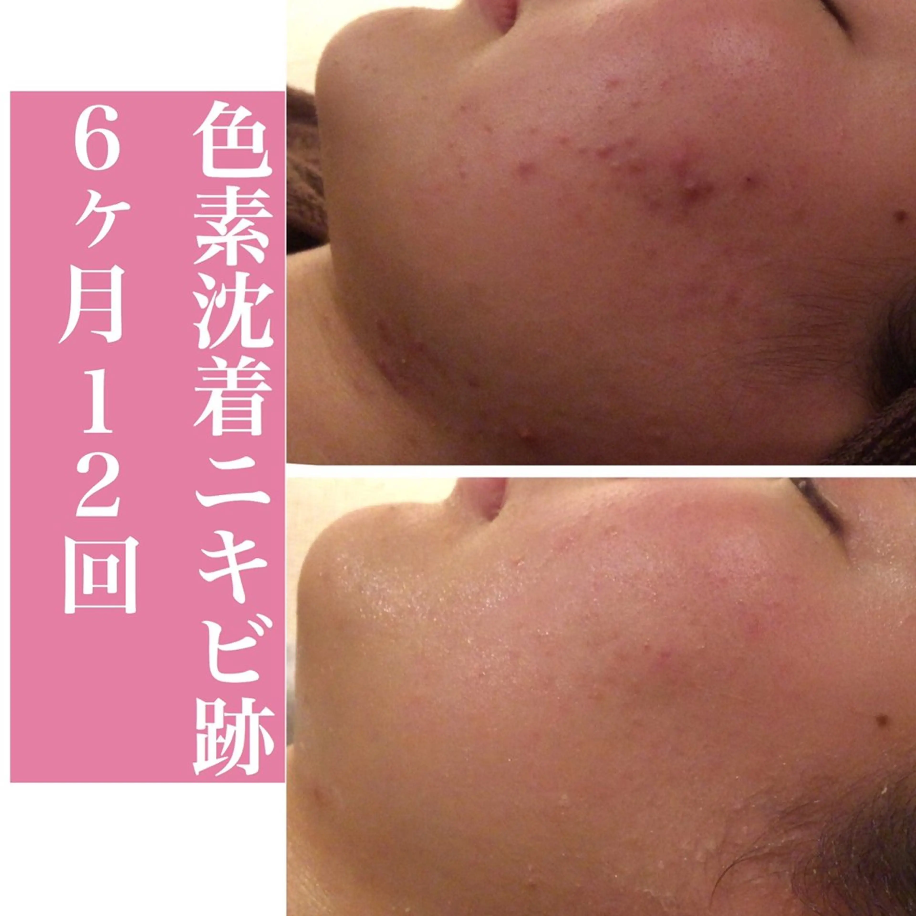 エステ リラク ニキビ・肌質改善専門 ♡人生が変わるサロンのエステ・リラクイメージ