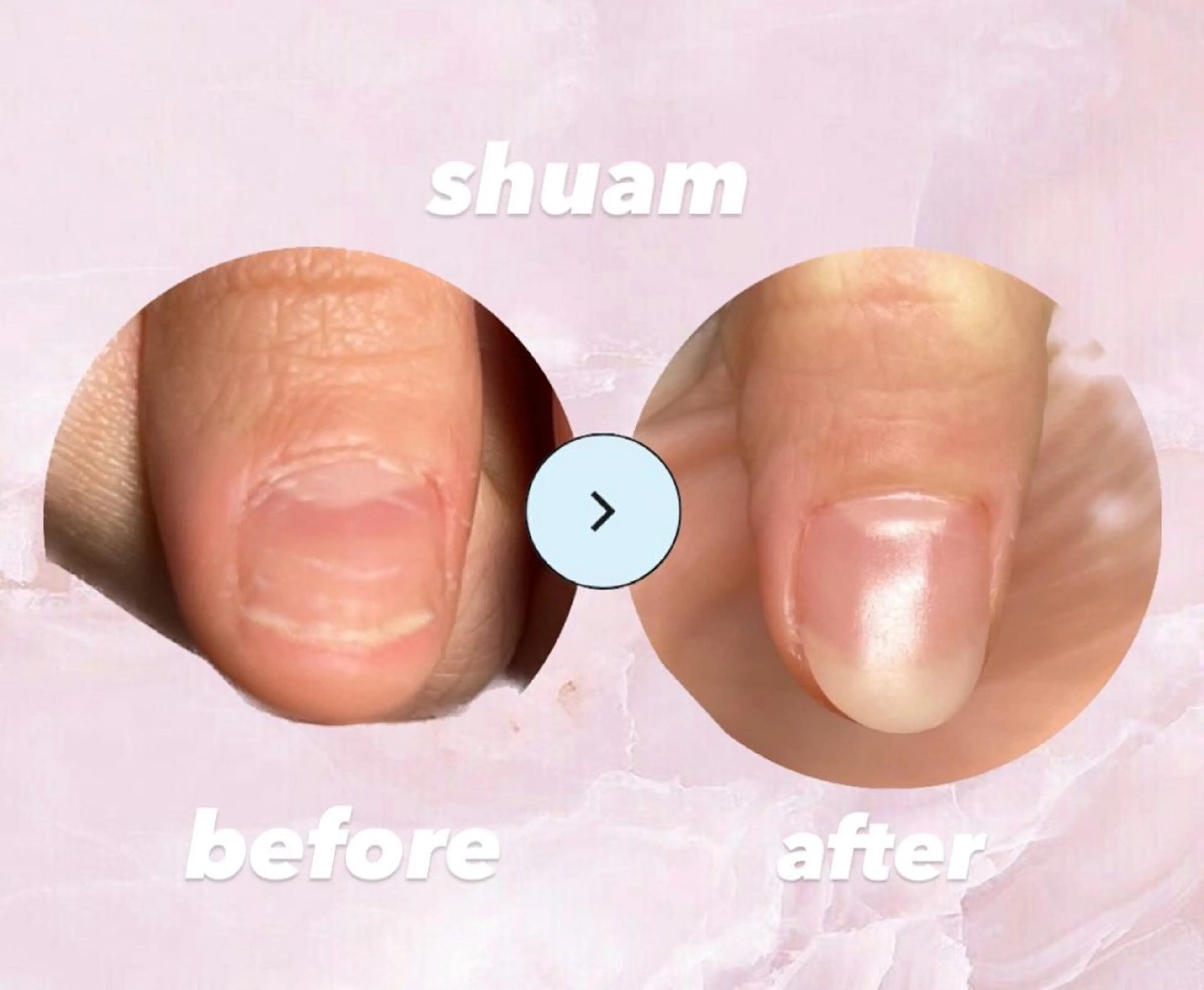 メンズ ネイル ハンドネイル 爪ケア/深爪 自爪育成 🐰えむのネイルデザイン