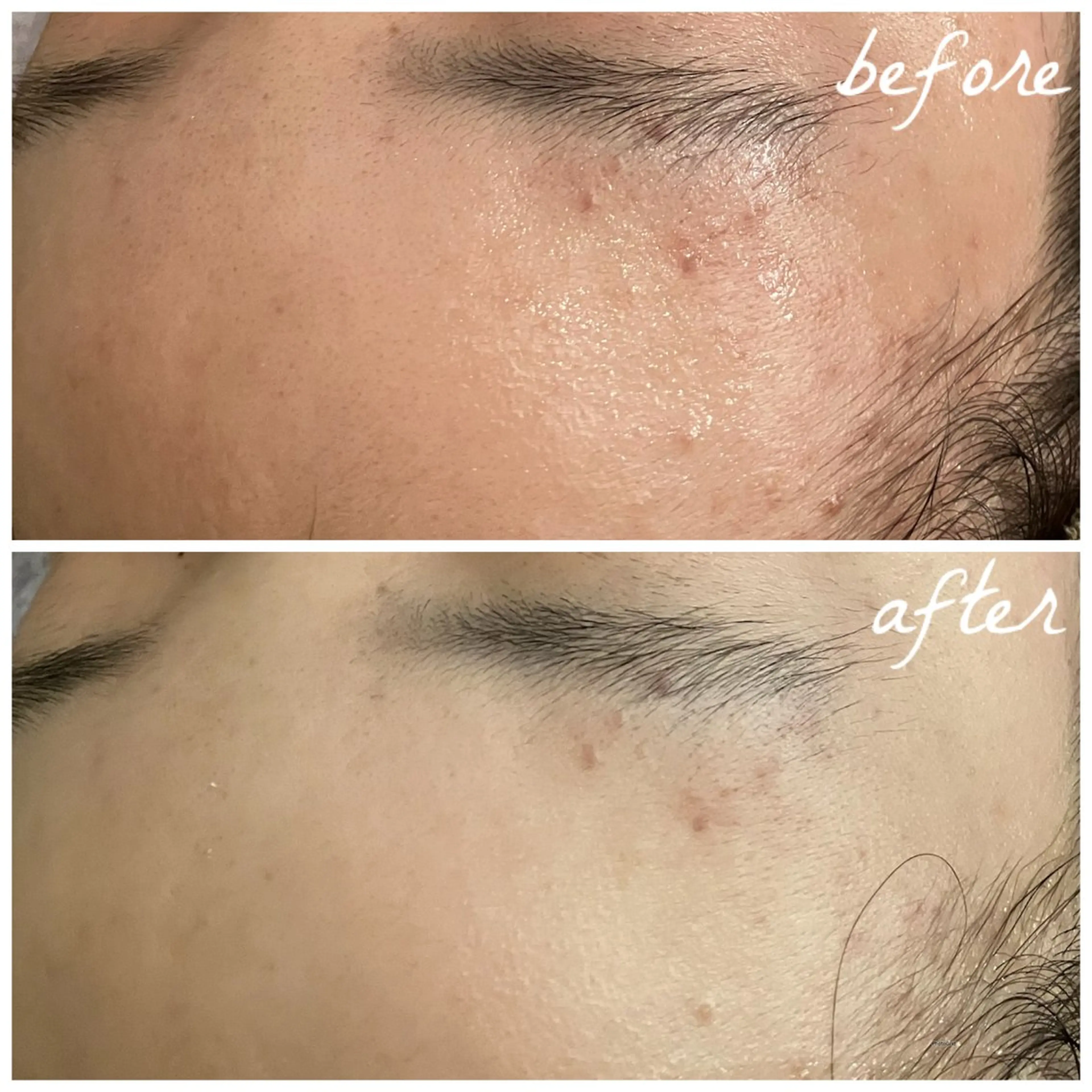 メンズ メナード岐阜茜部 杉浦のエステ・リラクイメージ