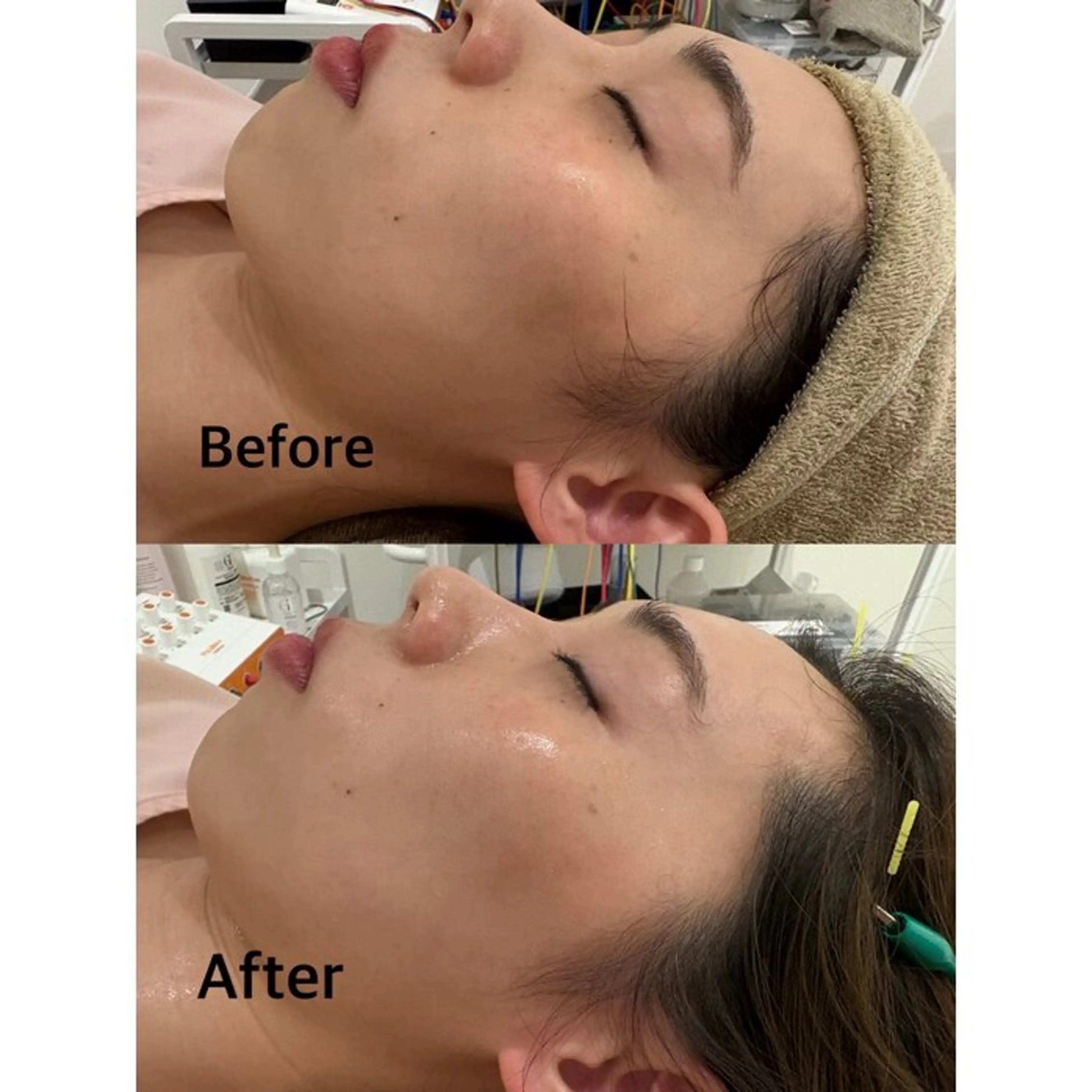 鍼灸サロン mahorobaトモのエステ・リラクイメージ