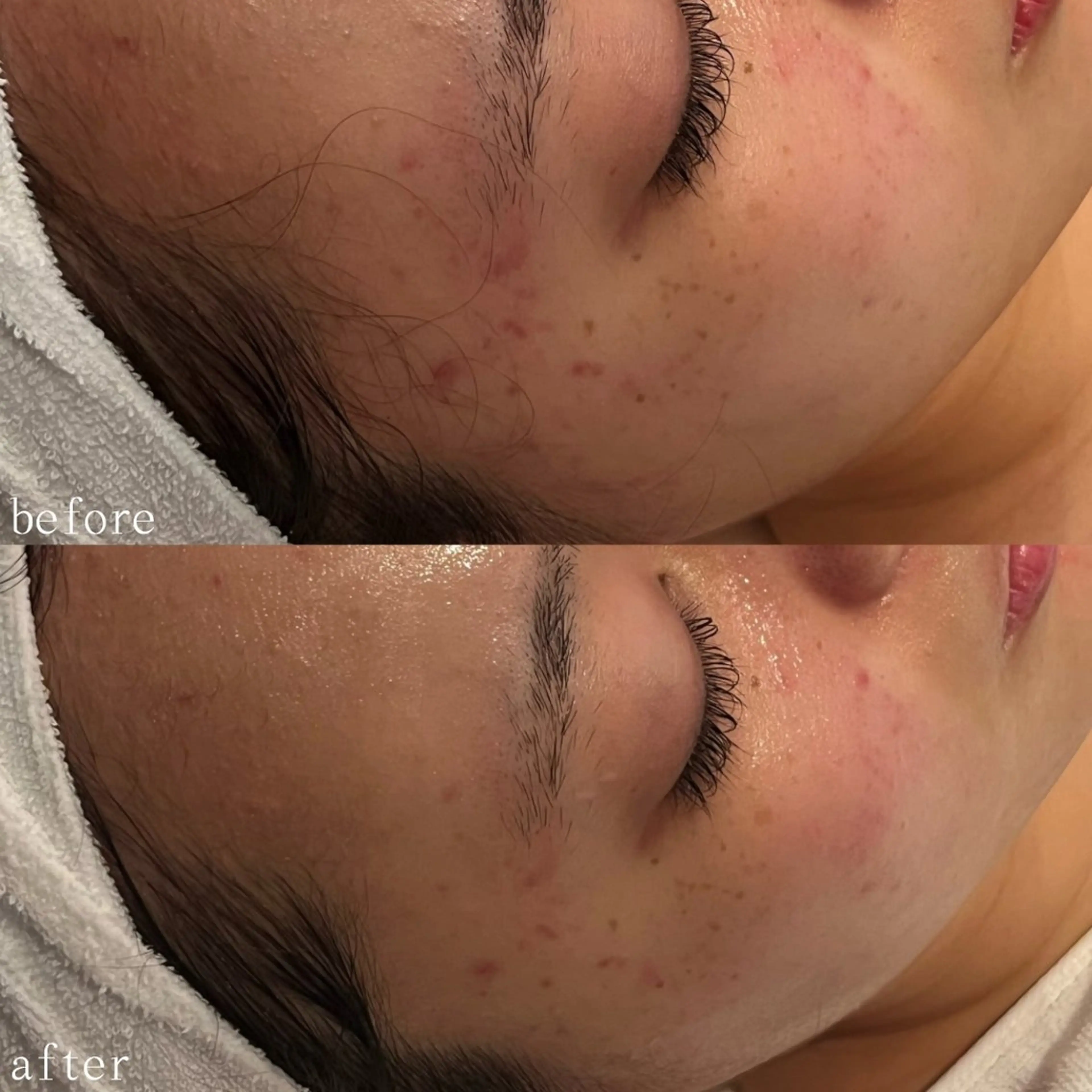 デ・アイム心斎橋所属・肌質改善サロン🫧 MAIのエステ・リラクイメージ