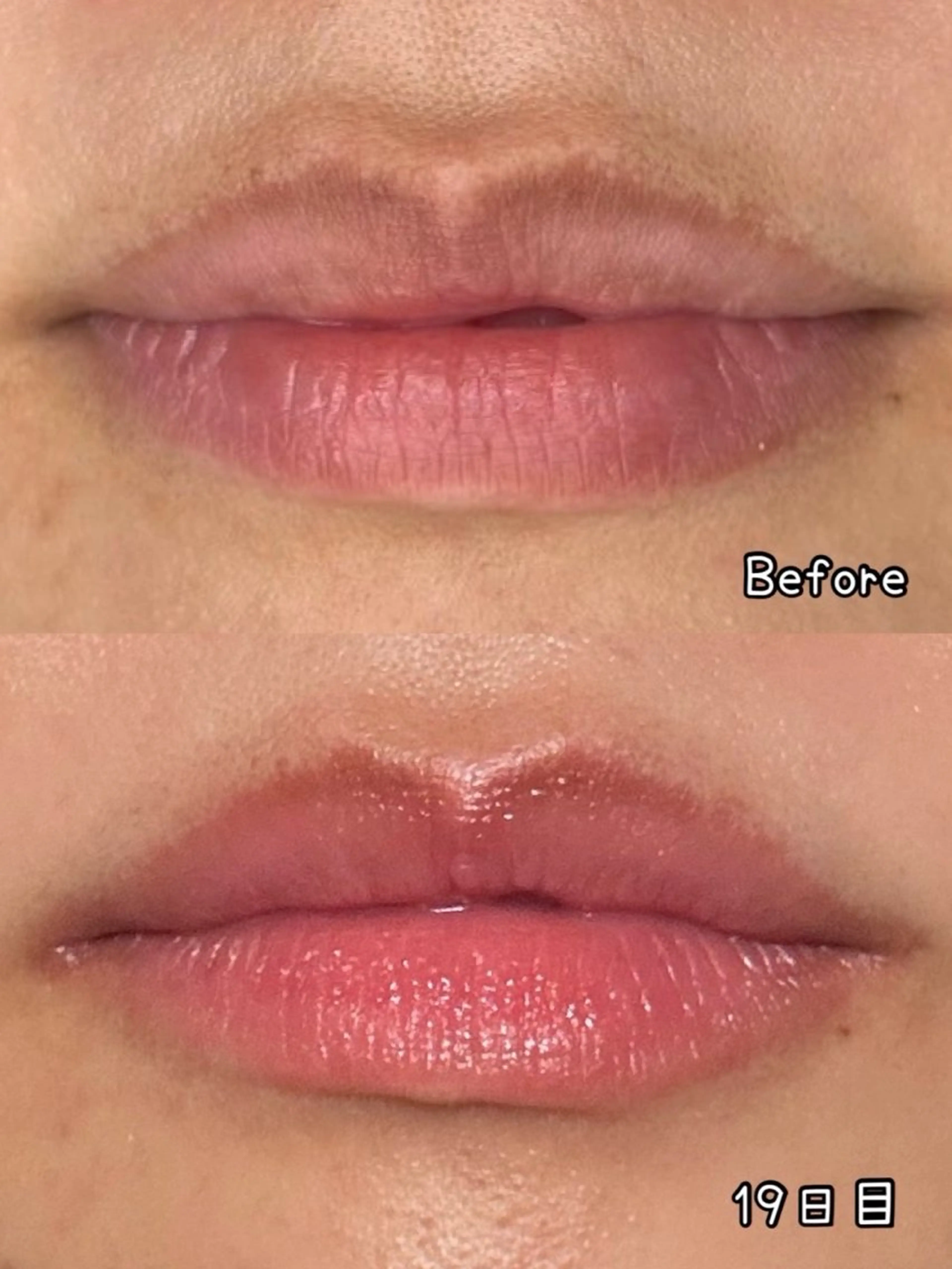 Esthesalon MOONのその他イメージ