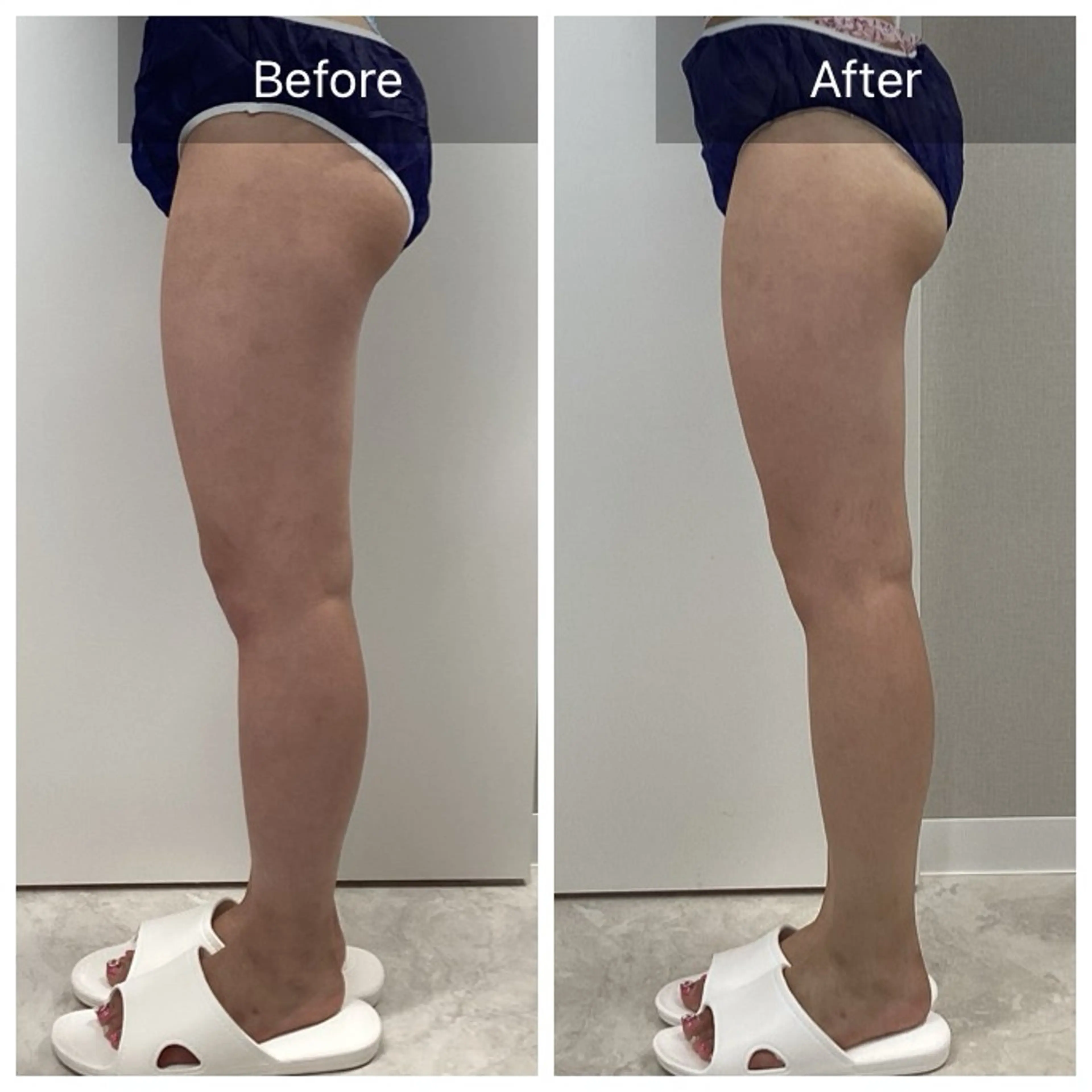 エステ Dahlia Akariのエステ・リラクイメージ