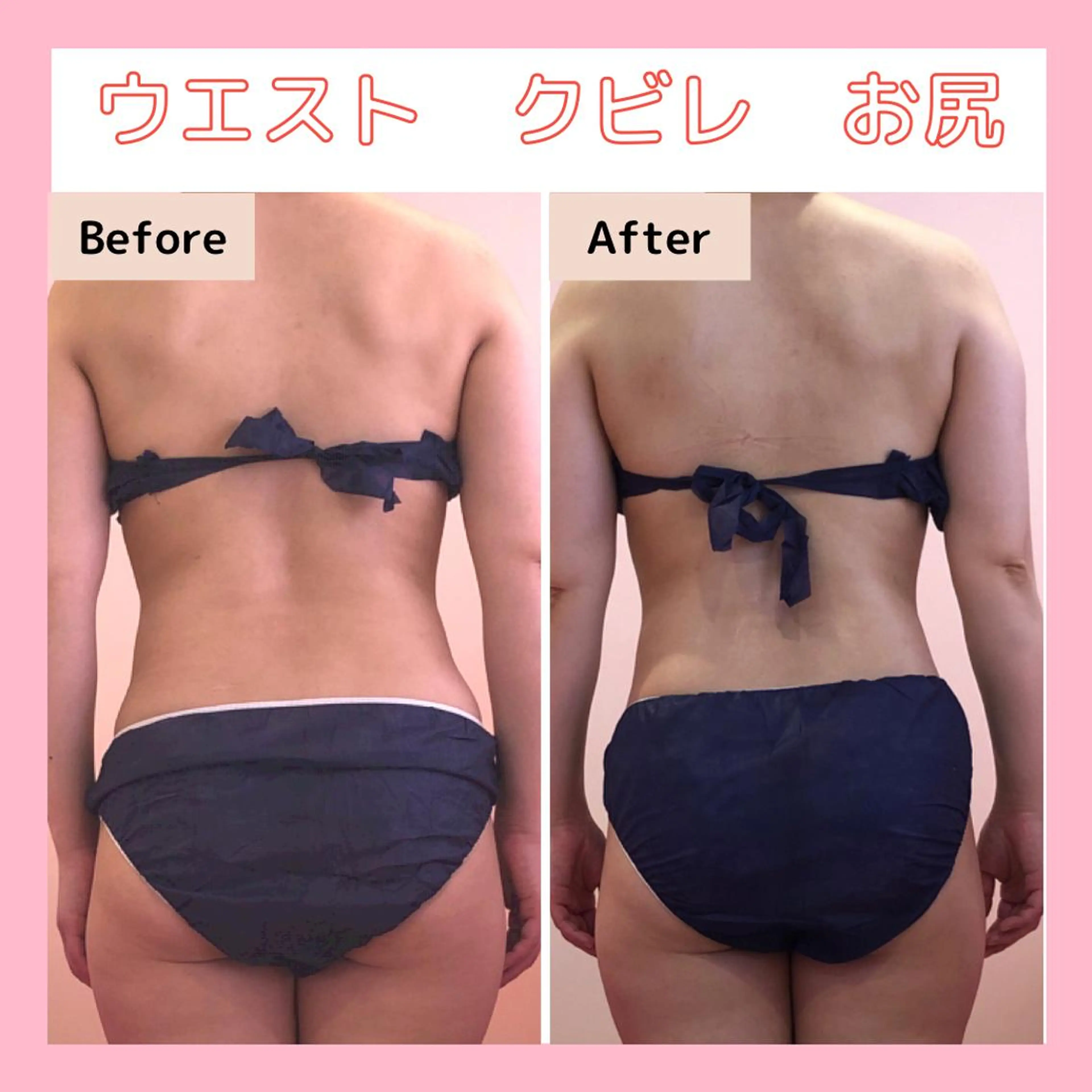 エステサロン　Sブランペタル所属・三沢市エステサロン Sブランペタルのエステ・リラクイメージ