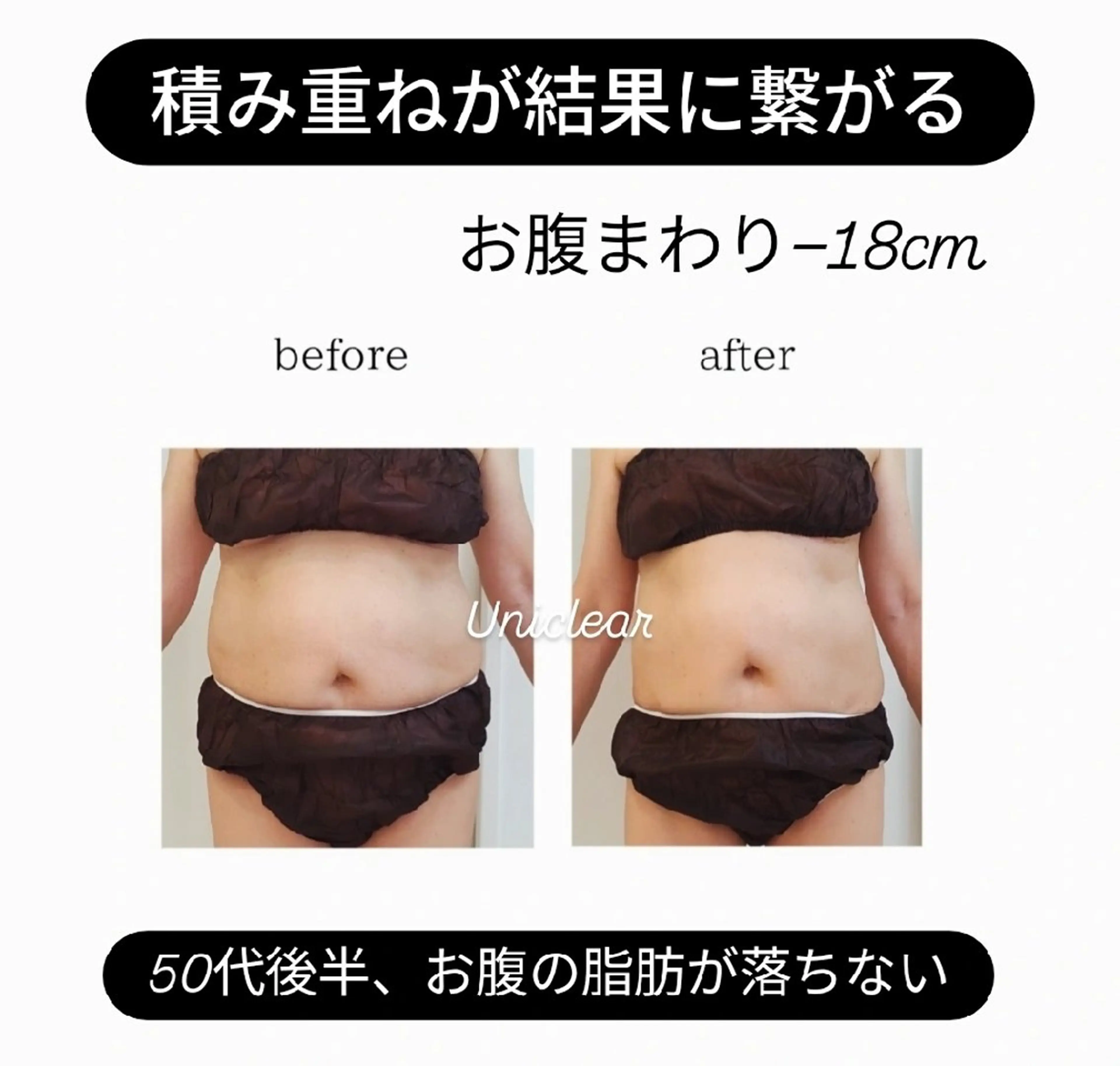 エステ リラク ユニセックスエステサロンUniclear所属・痩身&フェイシャル Uniclearのエステ・リラクイメージ