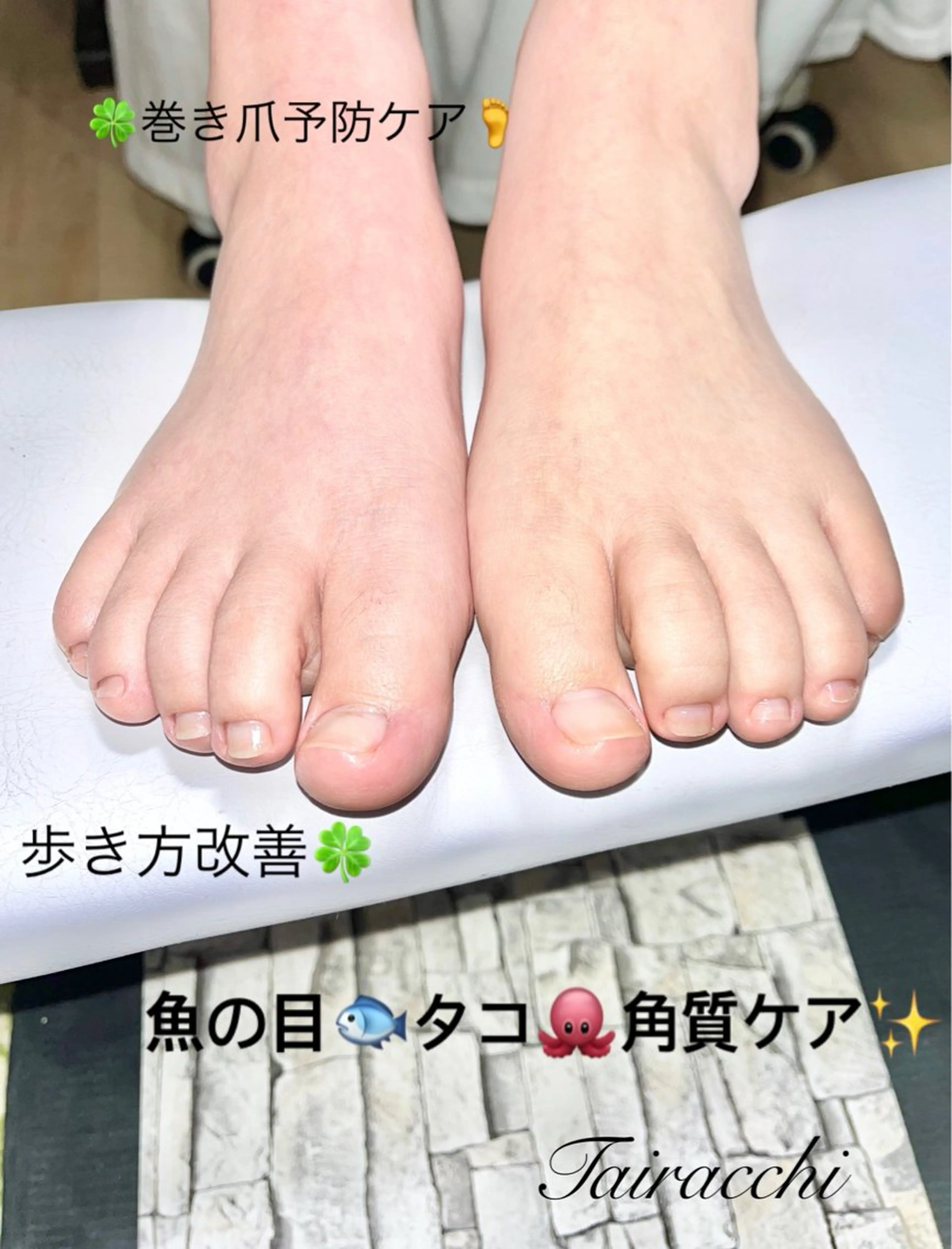 ネイル フットネイル フットネイル Tairacchi ﾀｲﾗｯﾁのエステ・リラクイメージ
