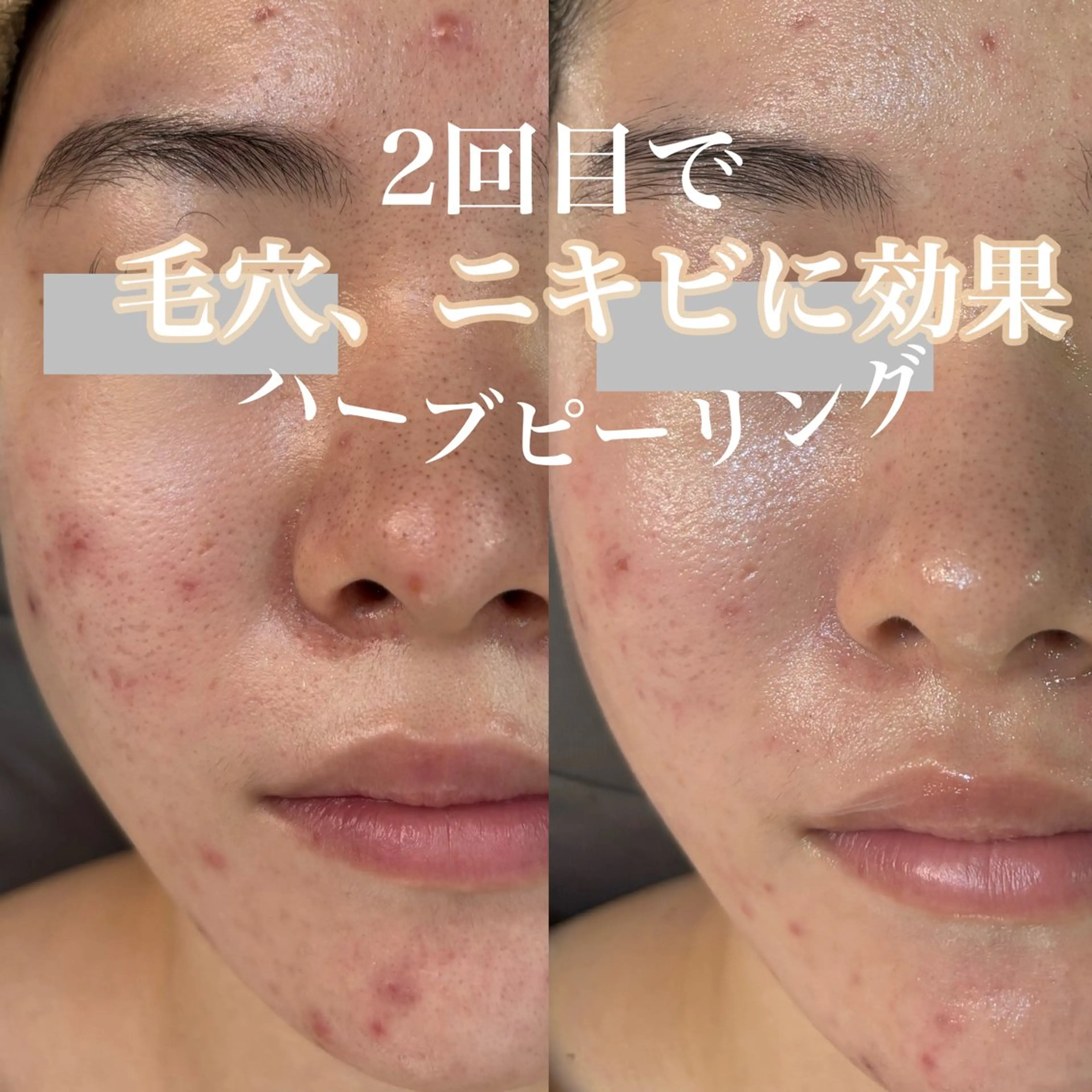 エステ WHITE AQUA 北千住店のエステ・リラクイメージ