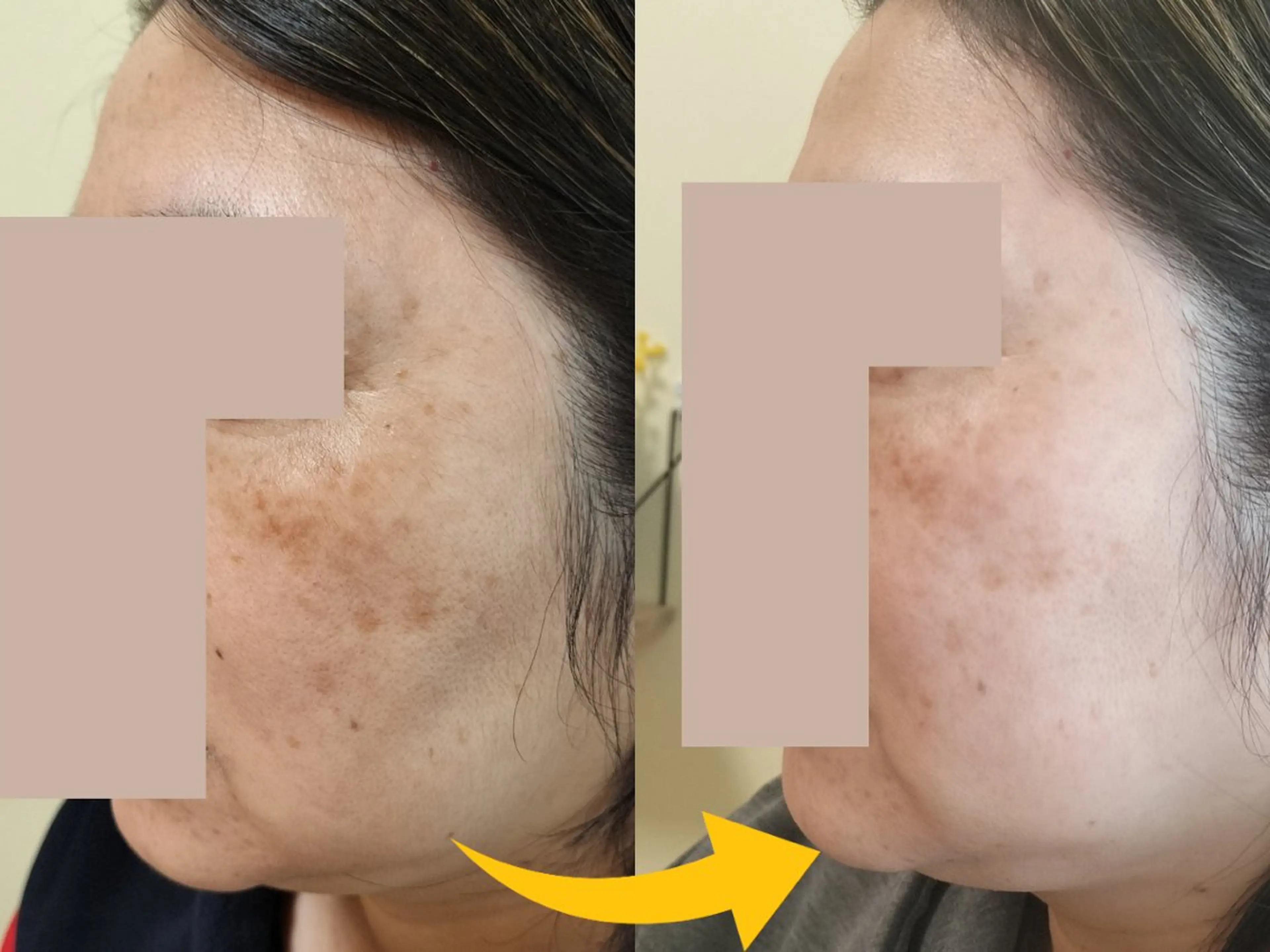 近藤 みさきのエステ・リラクイメージ