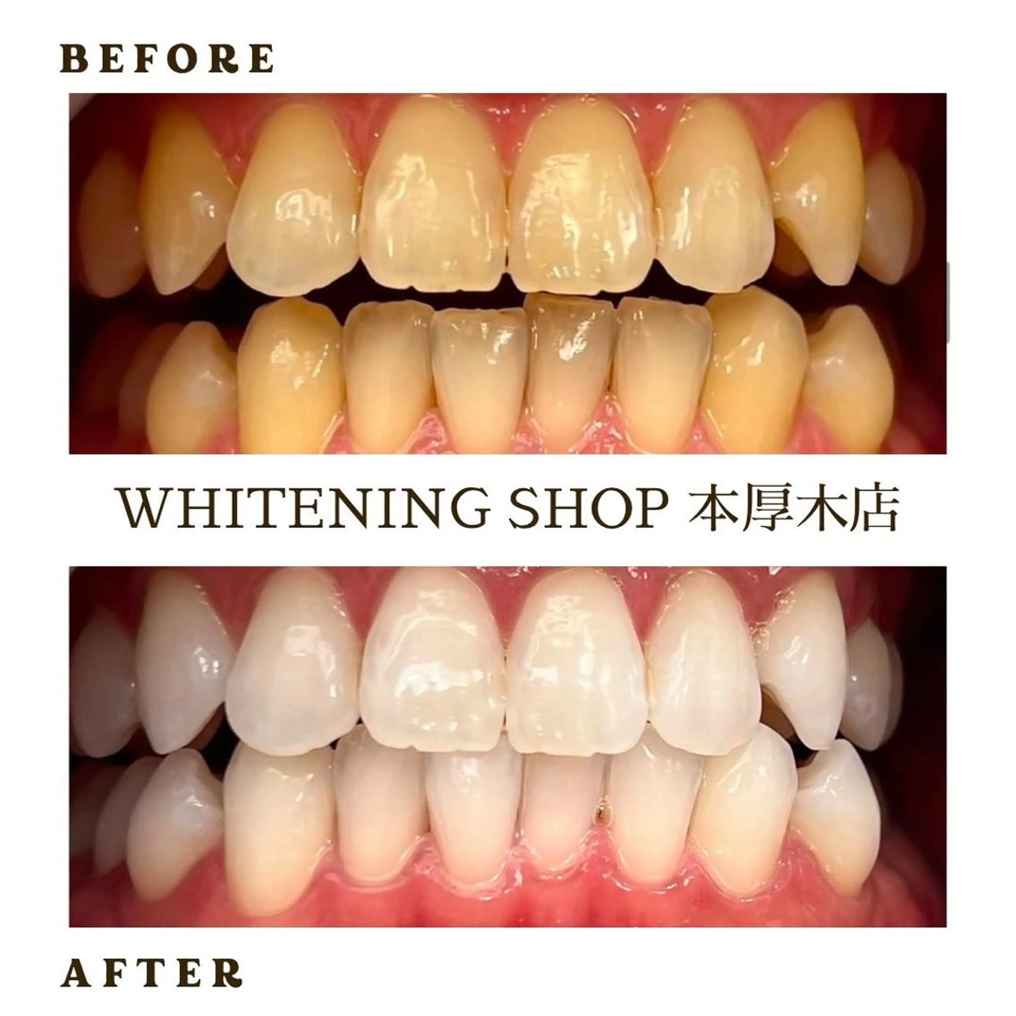メンズ その他 ホワイトニング ショップ本厚木のその他イメージ