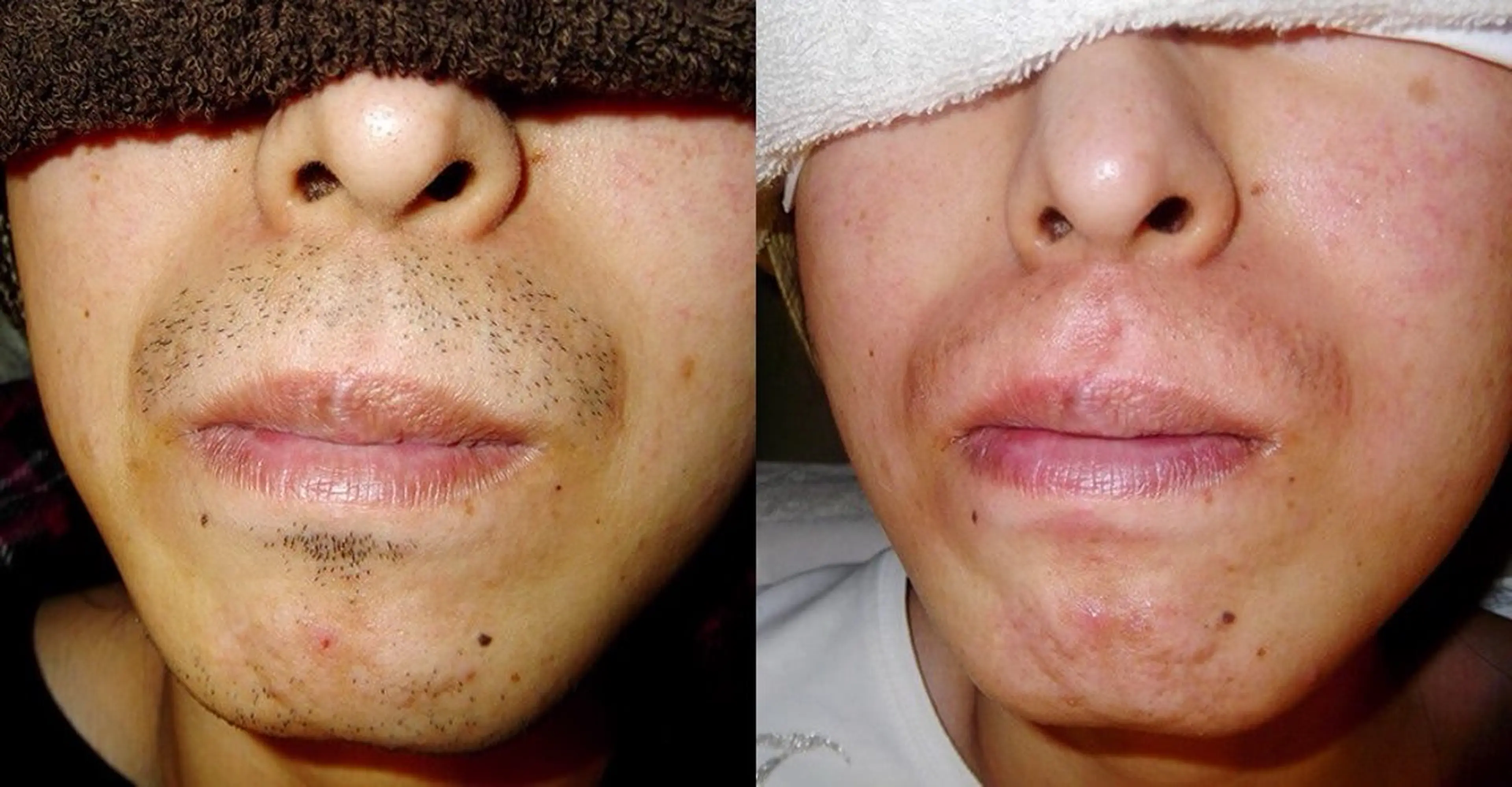 脱毛 YES脱毛サロン　大阪京橋店所属・メンズ脱毛サロン YESのエステ・リラクイメージ