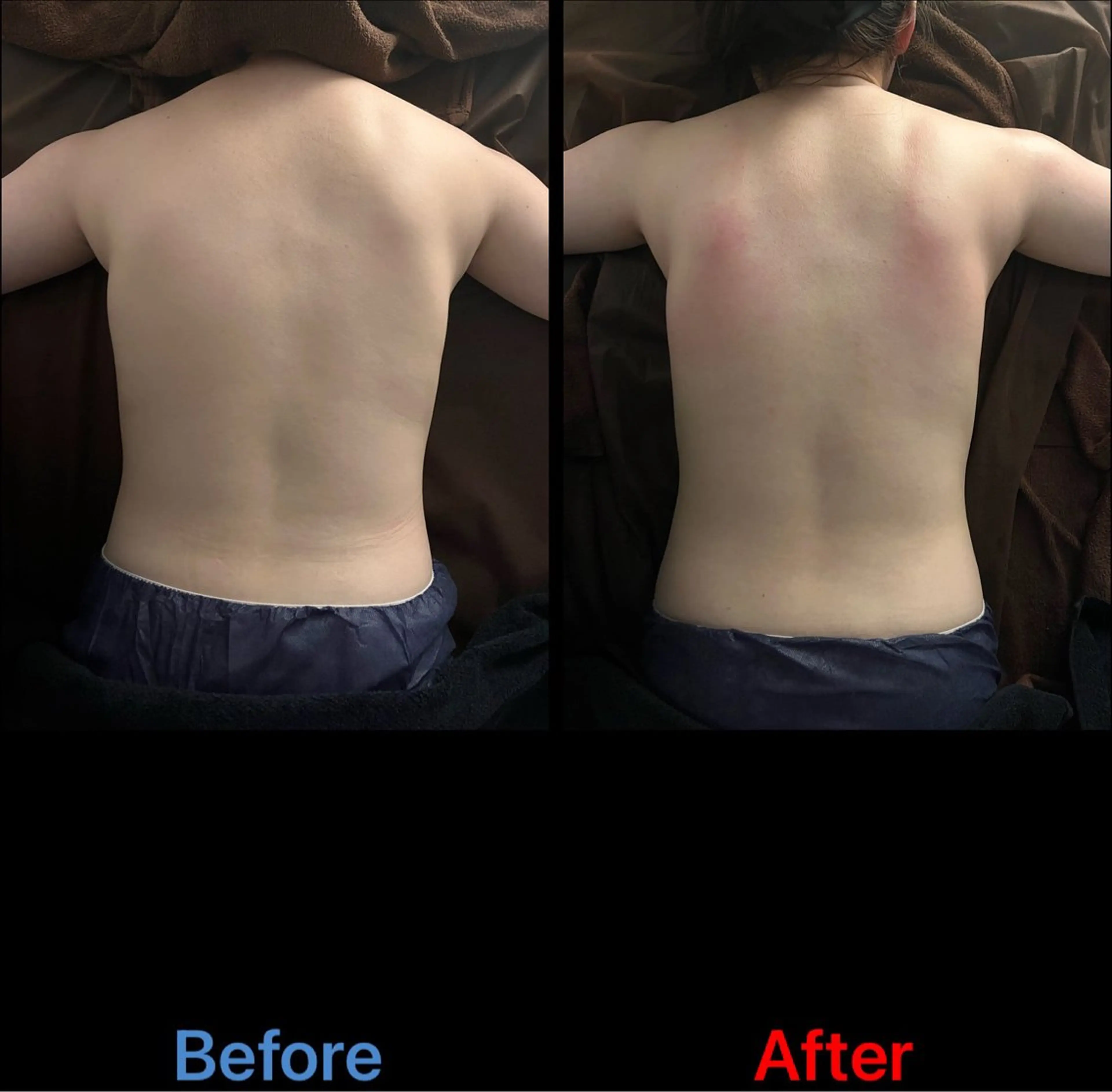 ホルモンバランス整う！全身＋バストアップ、不調改善たっぷり80分コースの写真