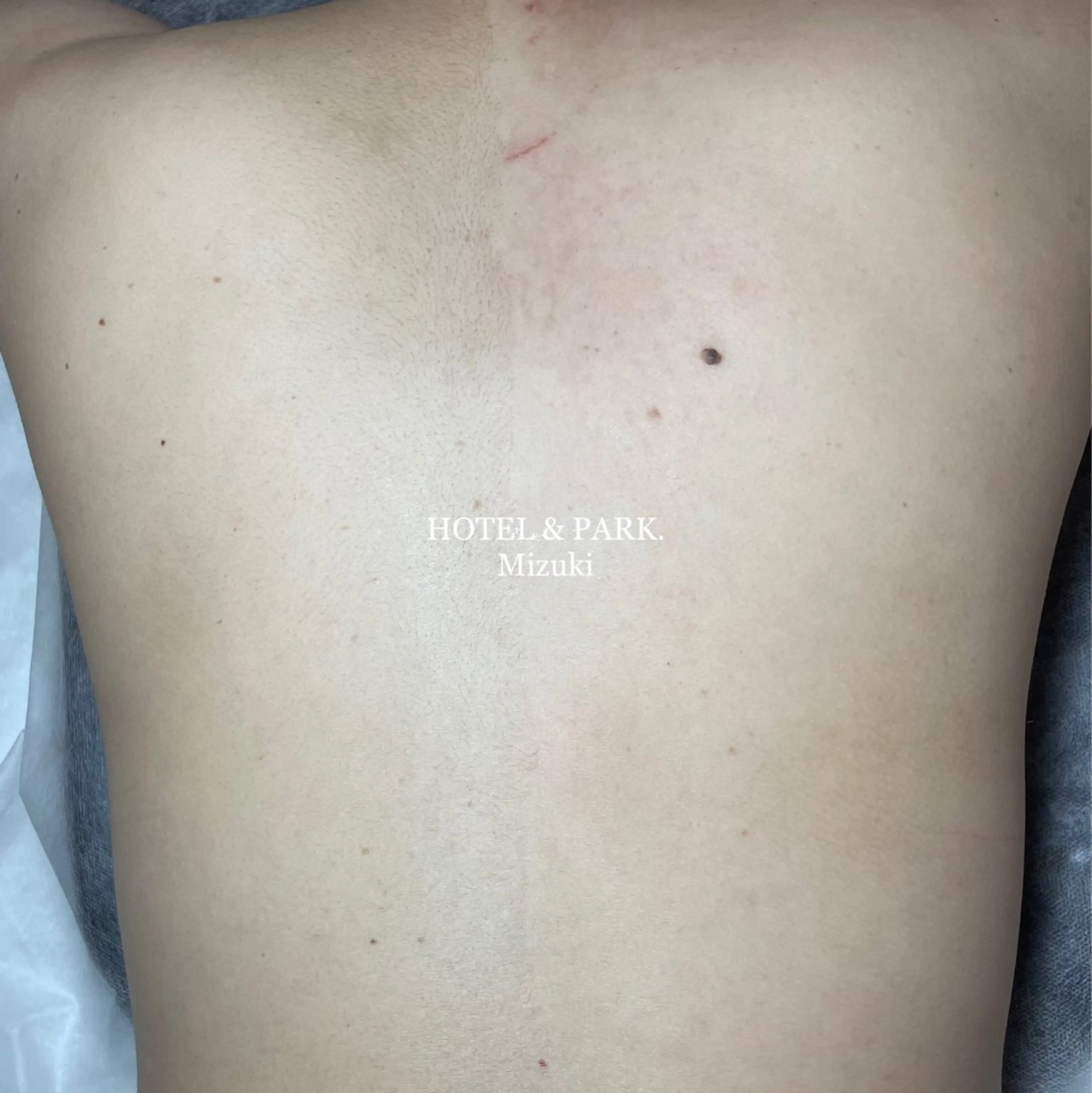 HOTEL&PARK . ワックス脱毛のエステ・リラクイメージ