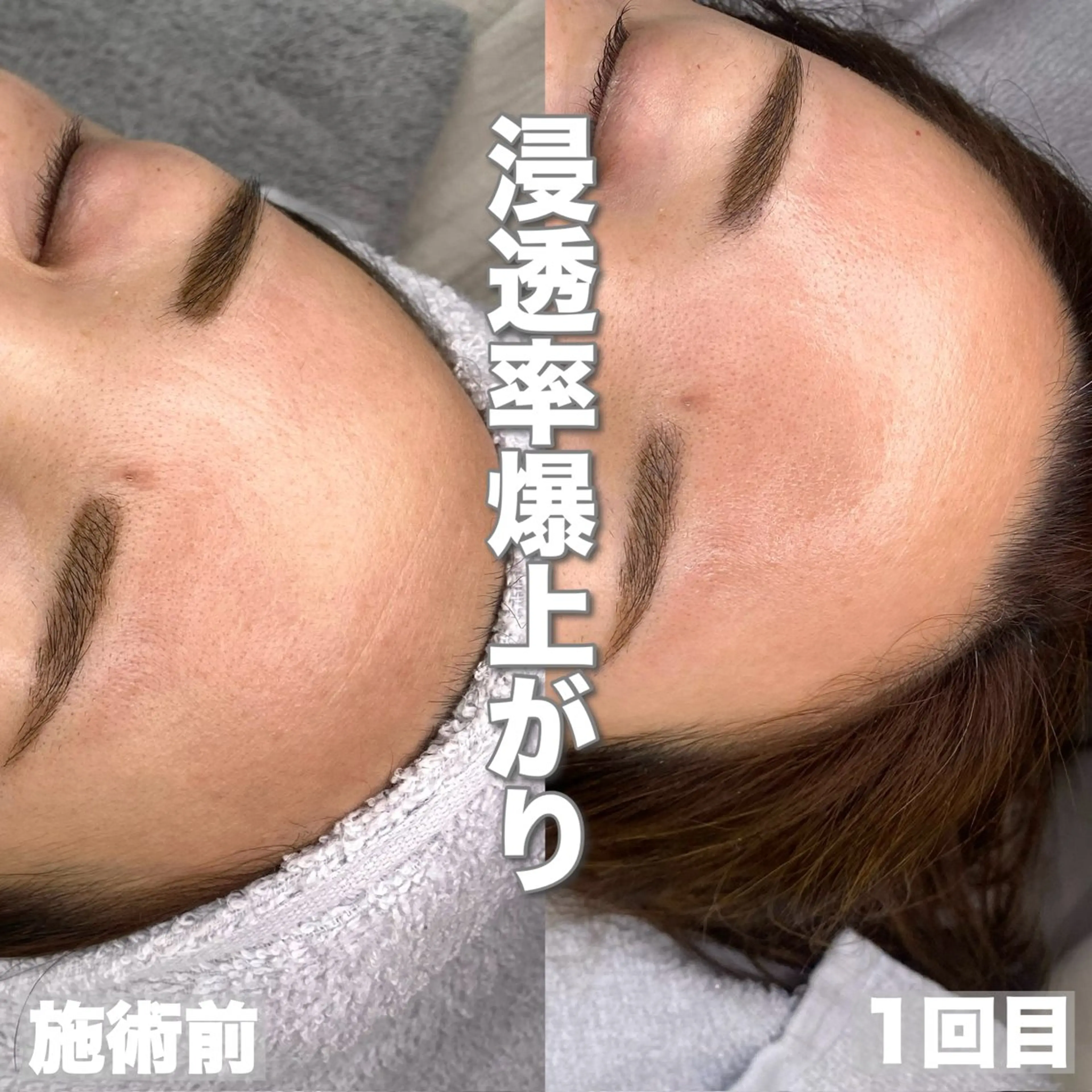 脱毛 mone~total care salon~所属・mone (モーネ)のマツエク・マツパデザイン