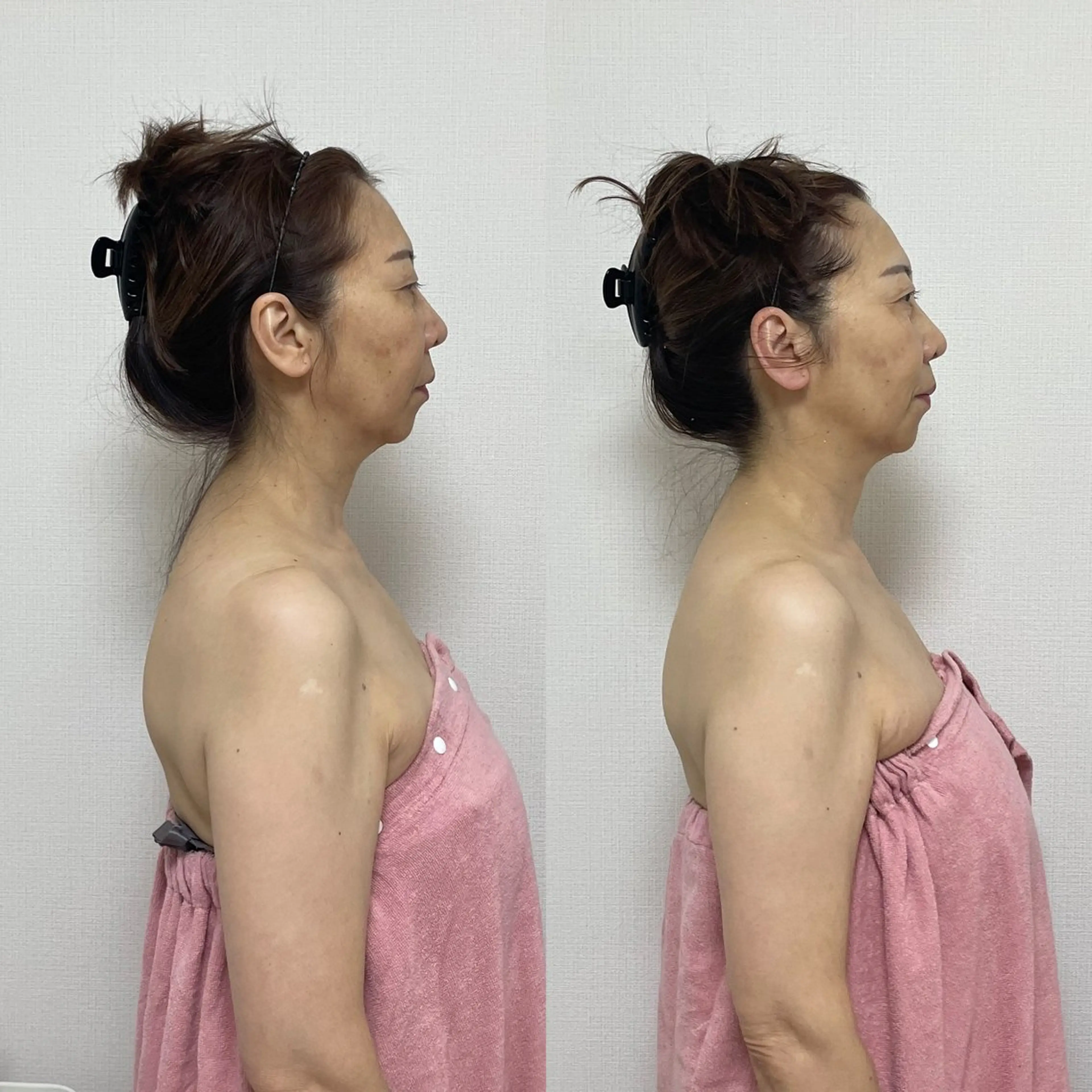 Salon TEN 肌質管理専門店のエステ・リラクイメージ