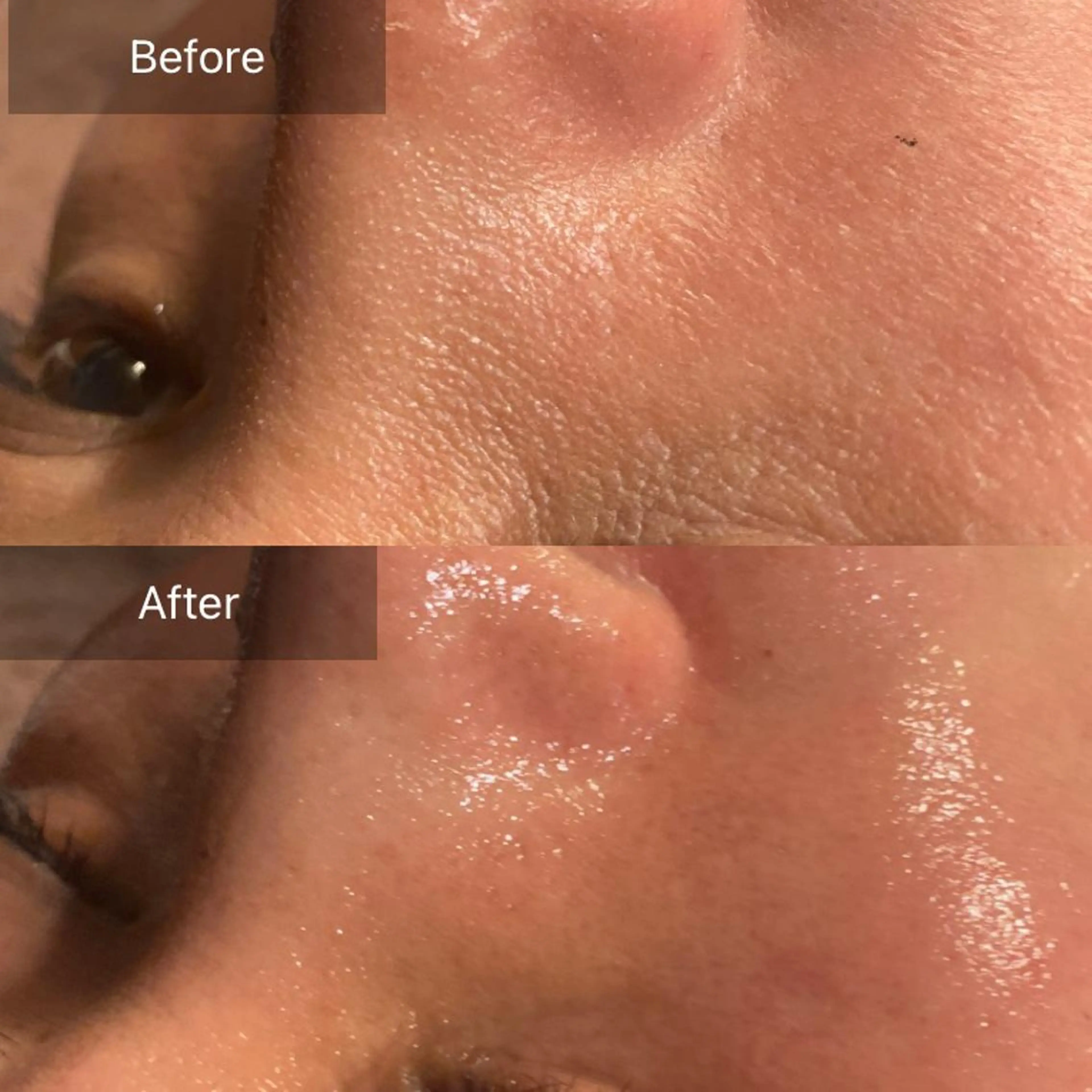 Mandarin Orange所属・毛穴から始める肌メン テマンダリンオレンジのエステ・リラクイメージ