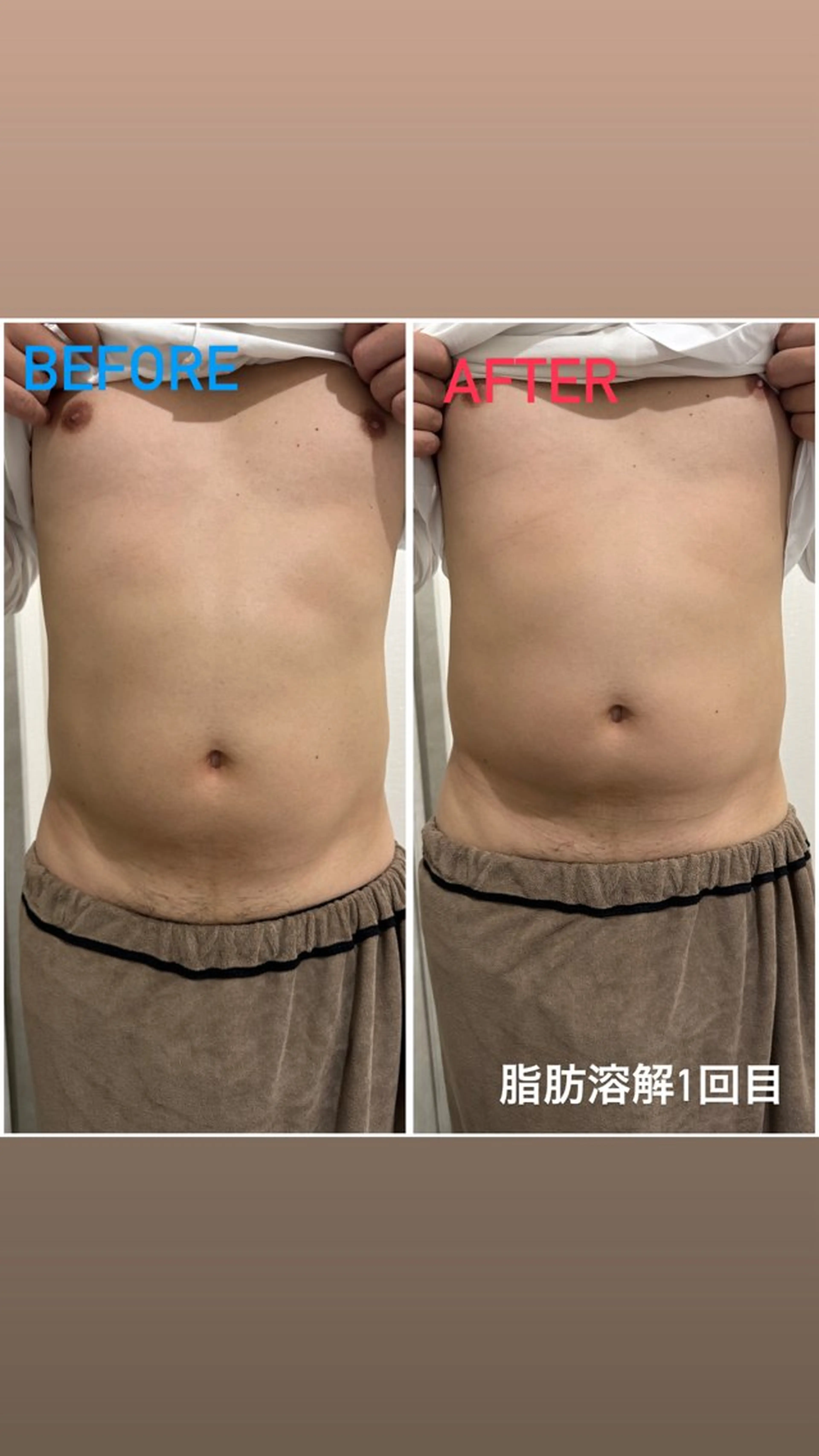 エステ アルカンジュ~archange~所属・痩身/毛穴洗浄/脱毛 アルカンジュのエステ・リラクイメージ