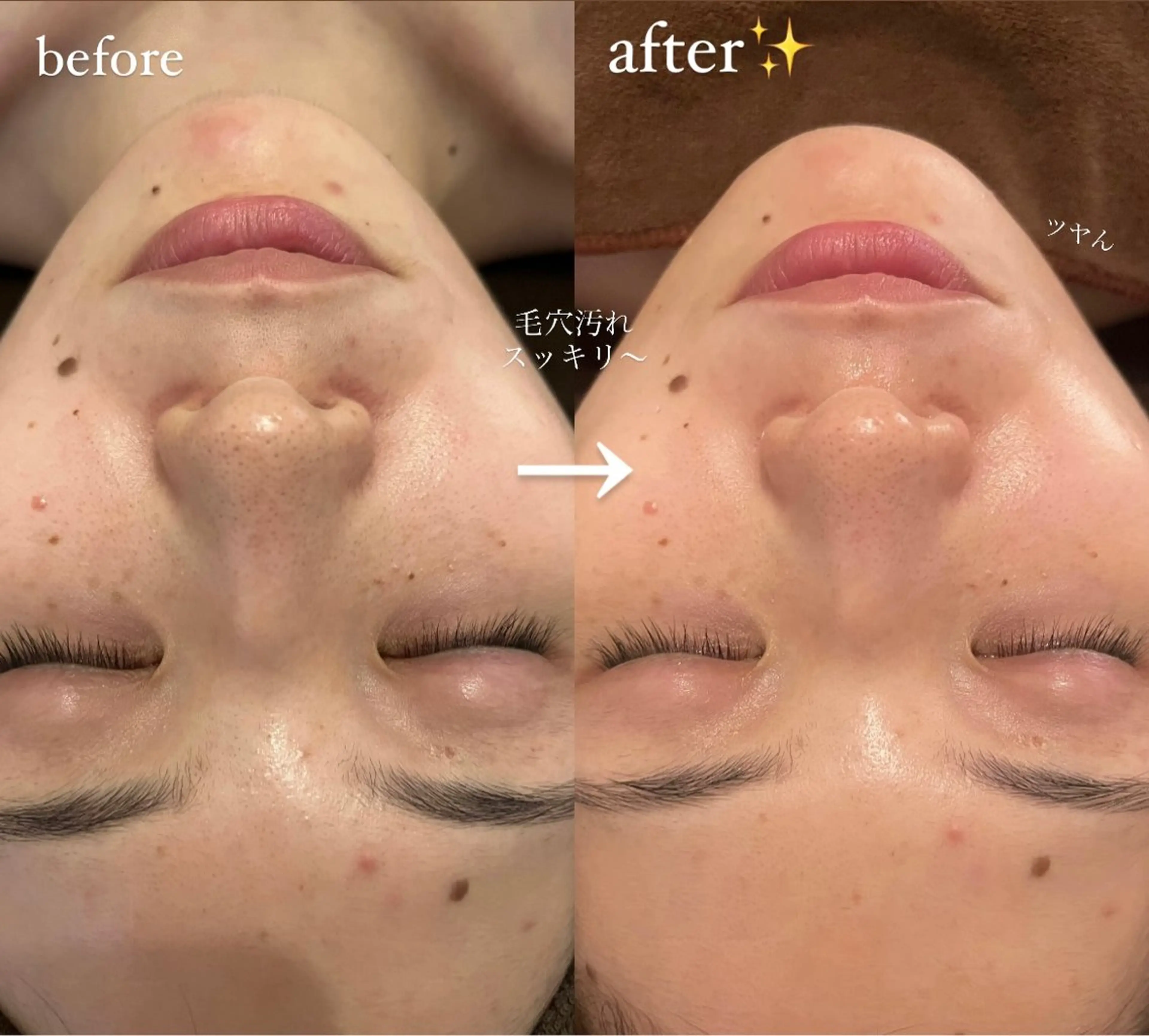 oyam オヤムのエステ・リラクイメージ