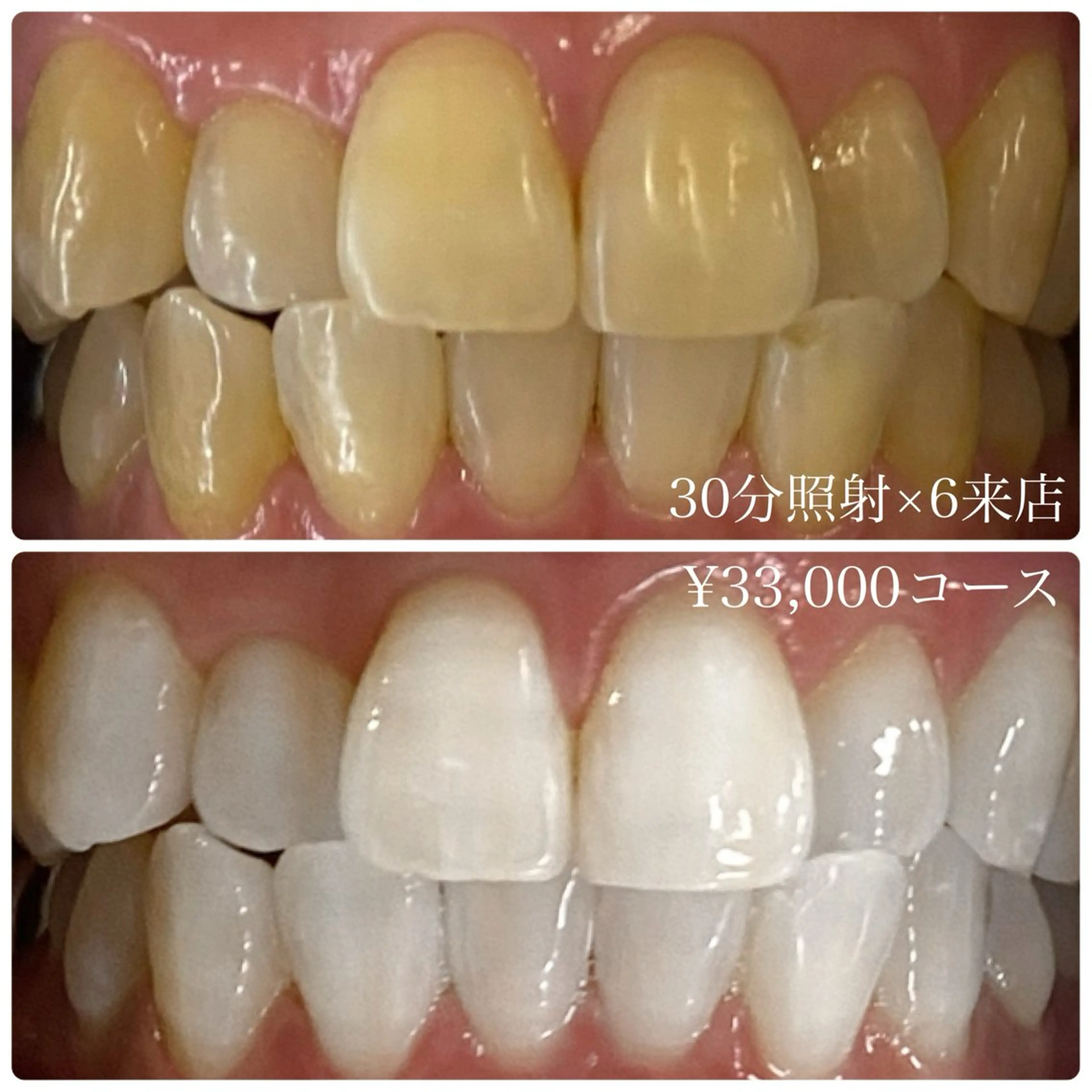 メンズ その他 ホワイトニングルーム　川崎店所属・ホワイトニング ルーム　川崎店のその他イメージ