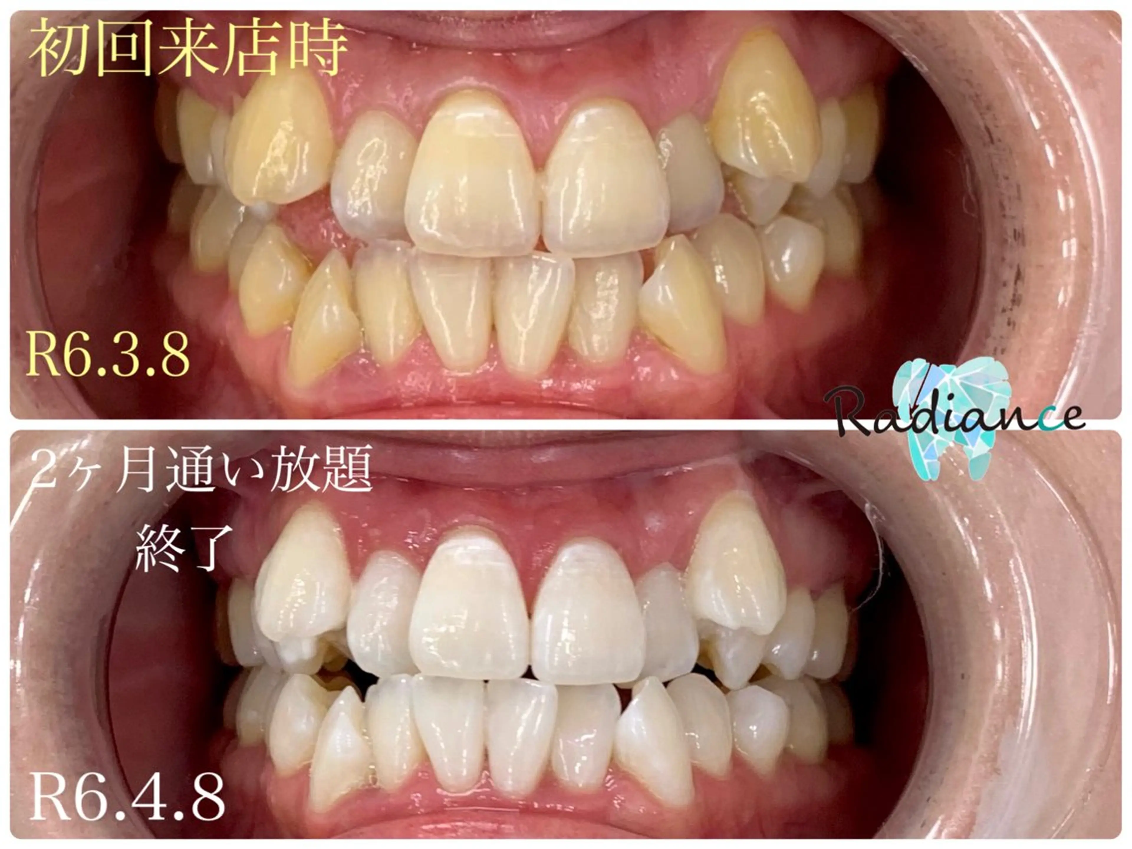 札幌ホワイトニング ラディアンス札幌駅店のその他イメージ