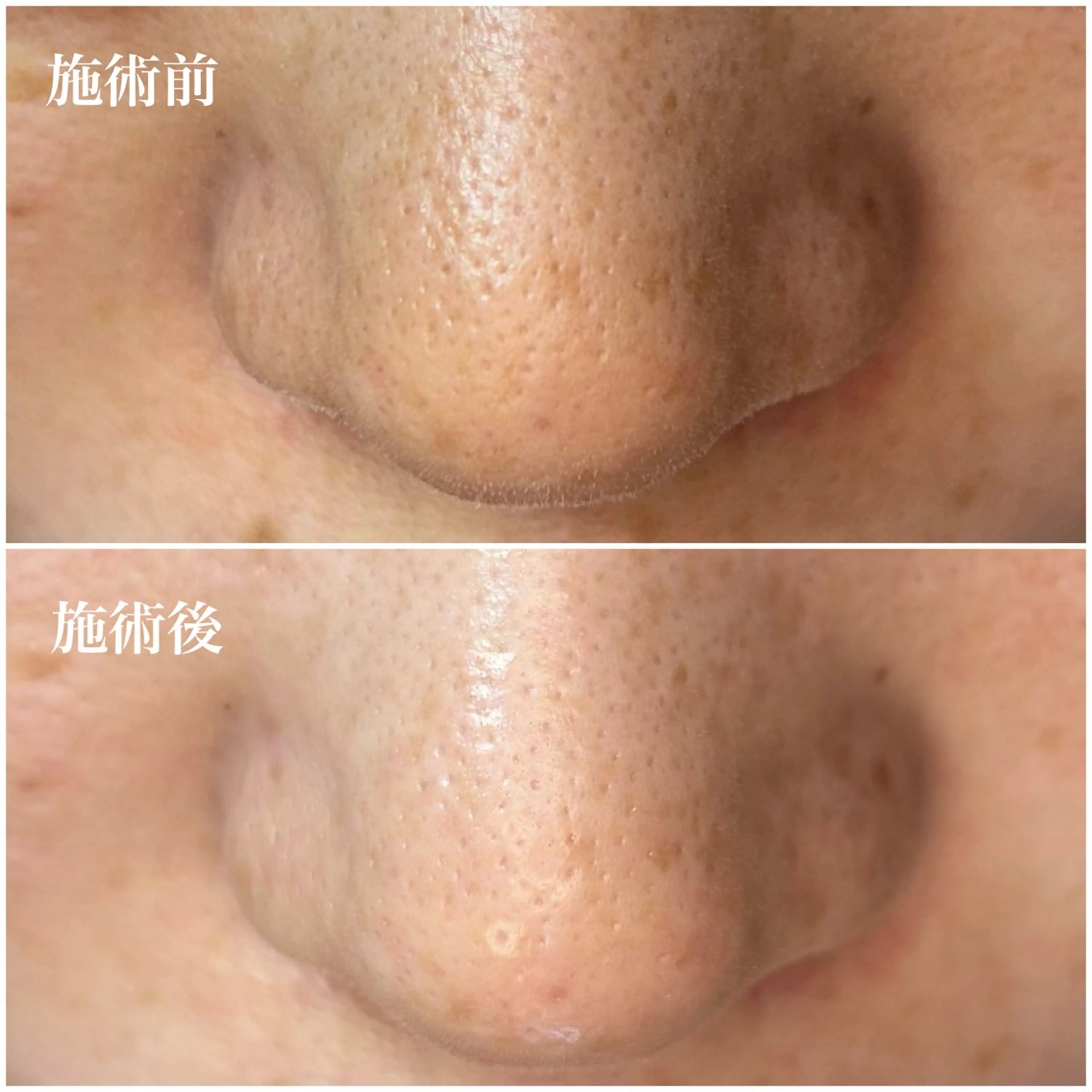 毛穴専門店アイミュー mamiのエステ・リラクイメージ