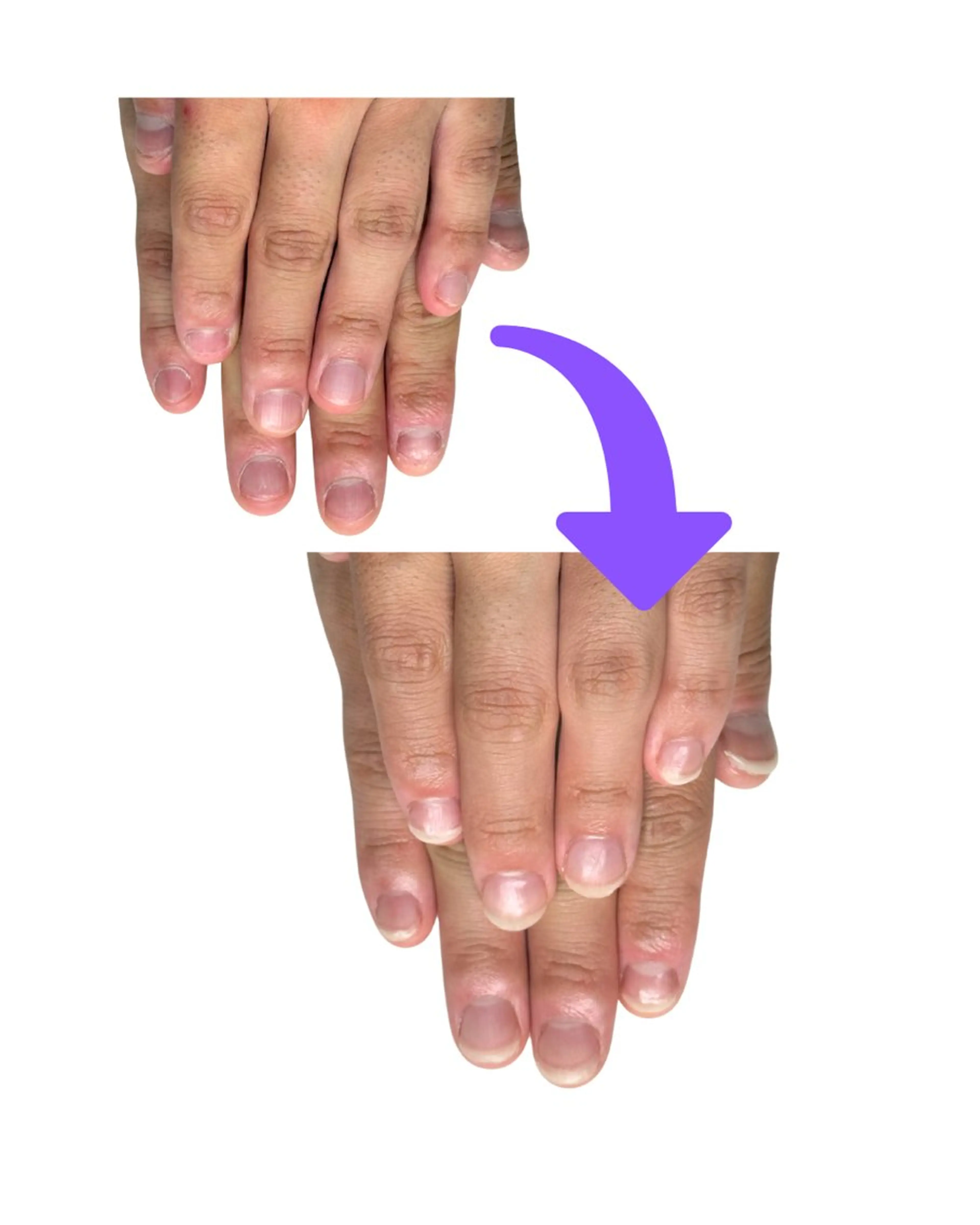 ネイル 深爪矯正専門店ネイルサロンKUU所属・ネイルサロン KUUのネイルデザイン