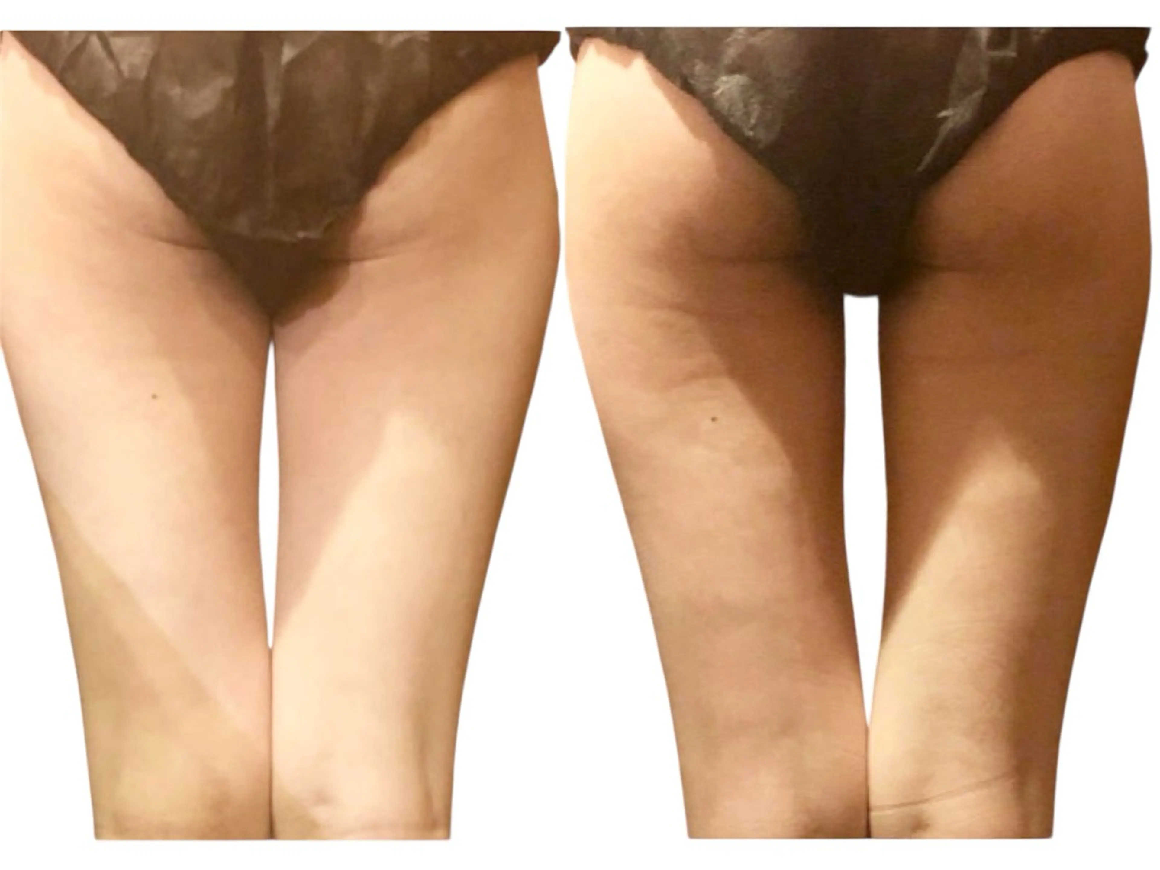 サロン美chill所属・骨格から変える痩身 サロン美chillのエステ・リラクイメージ