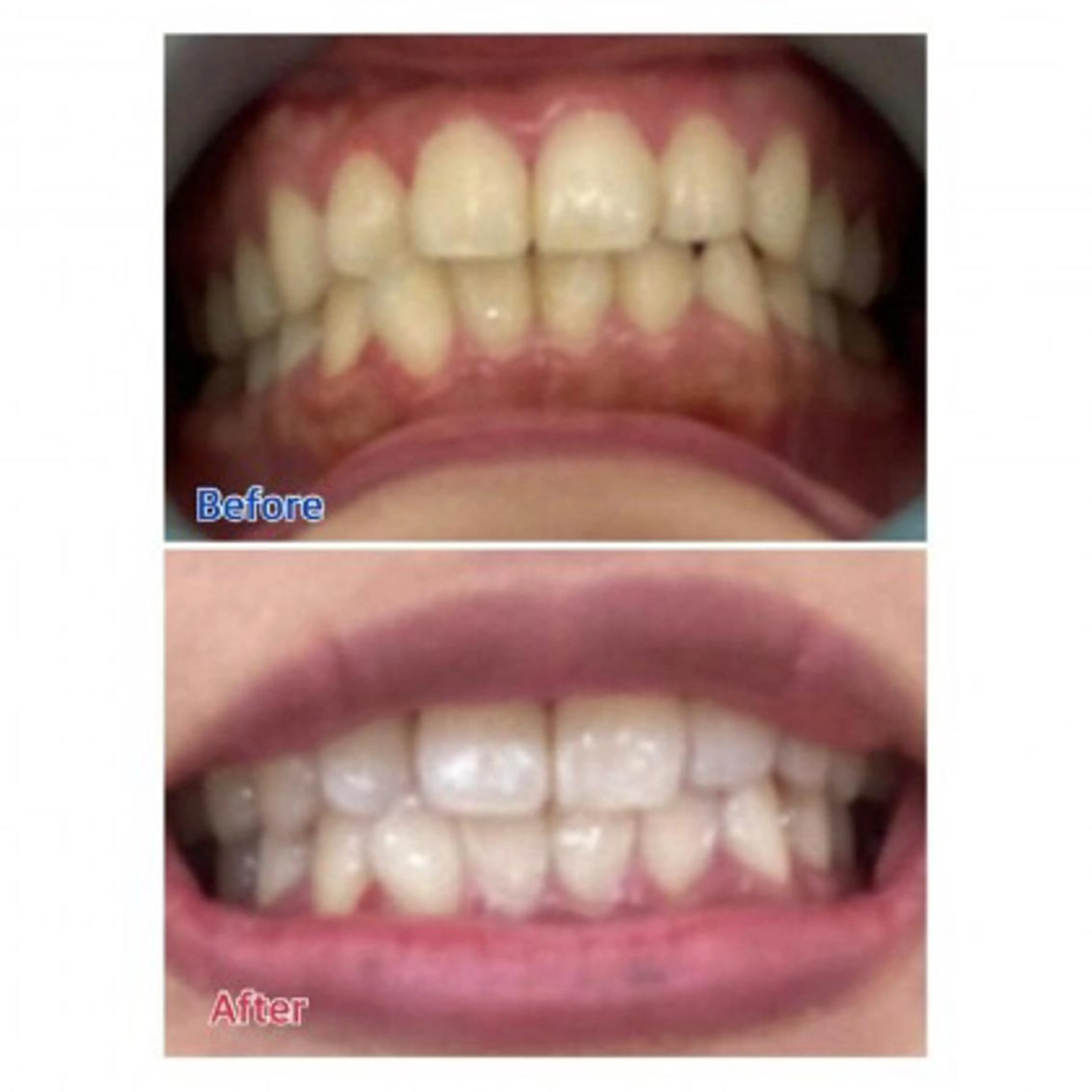 M渋谷店所属・Ｍ渋谷 ホワイトニングのエステ・リラクイメージ